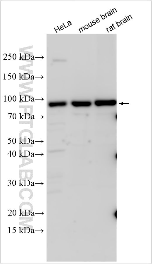 Western Blot (WB) analysis of various lysates using ATP2C1 Polyclonal antibody (13310-1-AP)