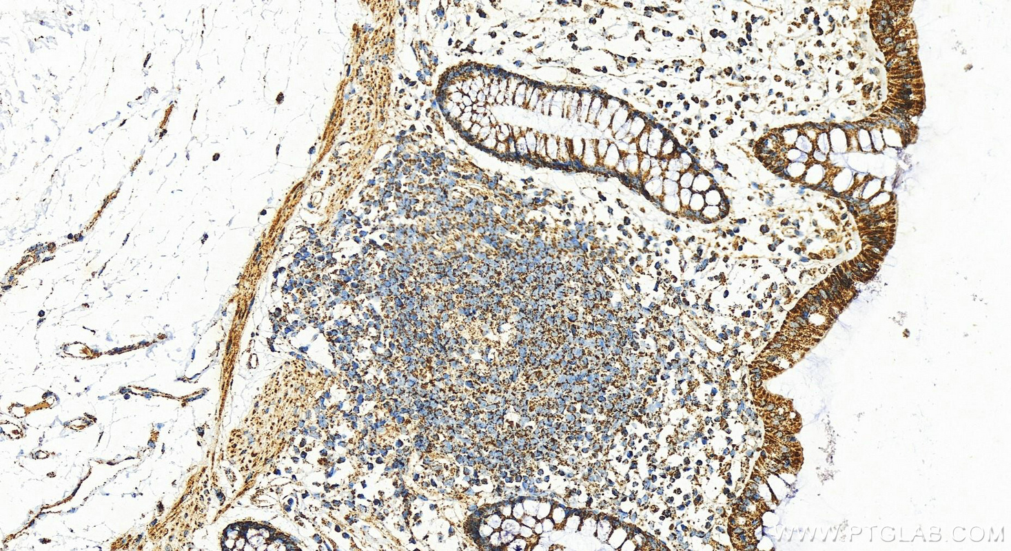 Immunohistochemistry (IHC) staining of human colon tissue using ATP5A1 Polyclonal antibody (14676-1-AP)