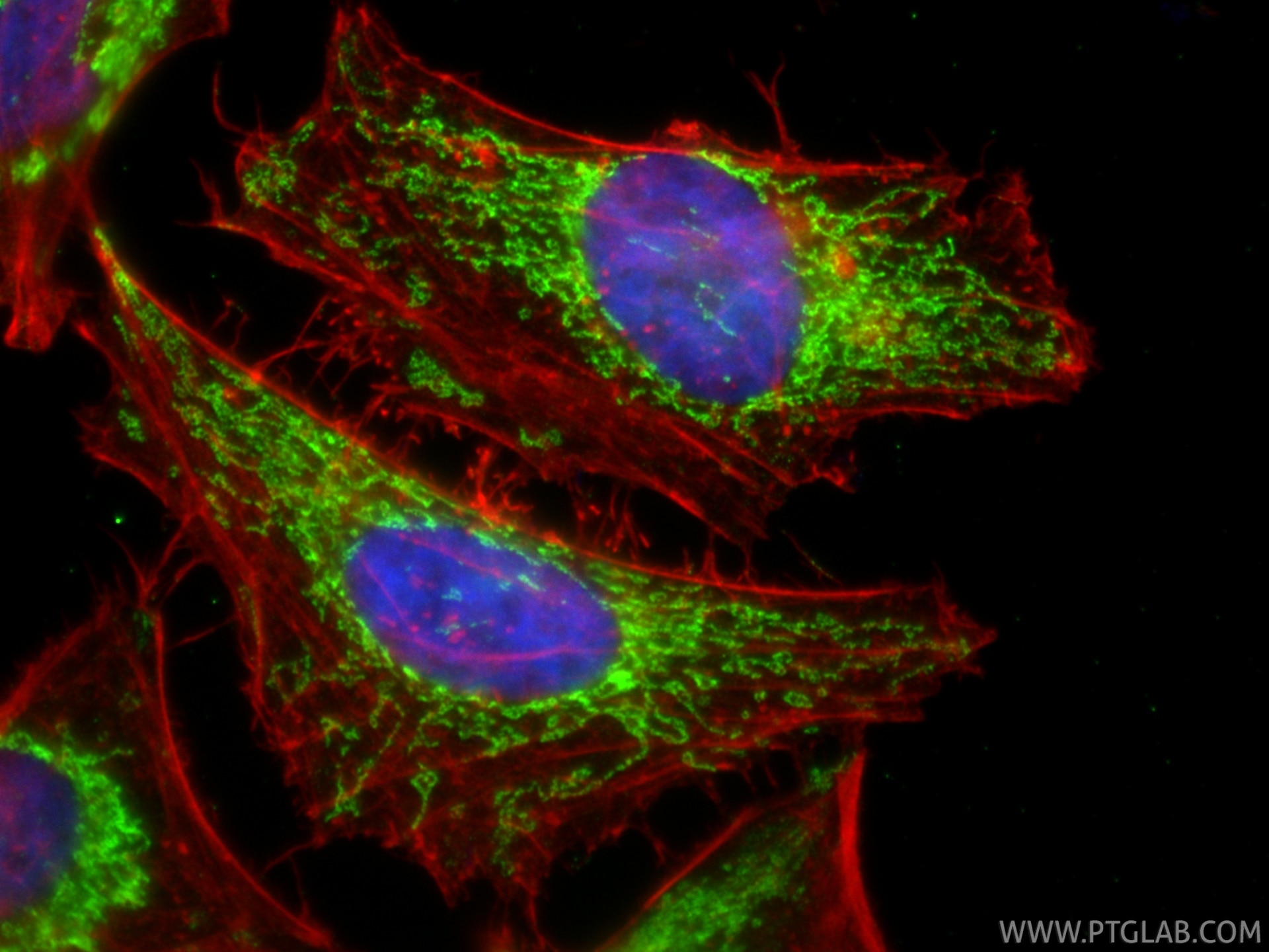 Immunofluorescence (IF) / fluorescent staining of HeLa cells using ATP5A1 Recombinant monoclonal antibody (82288-1-RR)