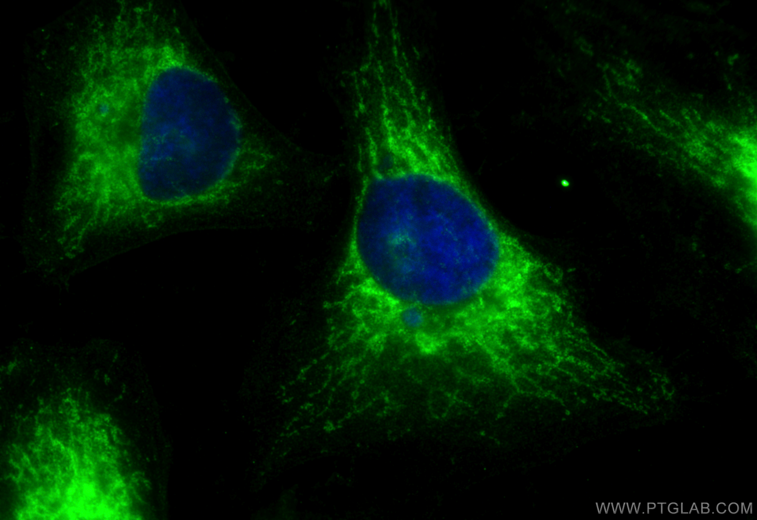 Immunofluorescence (IF) / fluorescent staining of HeLa cells using ATP5F1 Polyclonal antibody (15999-1-AP)