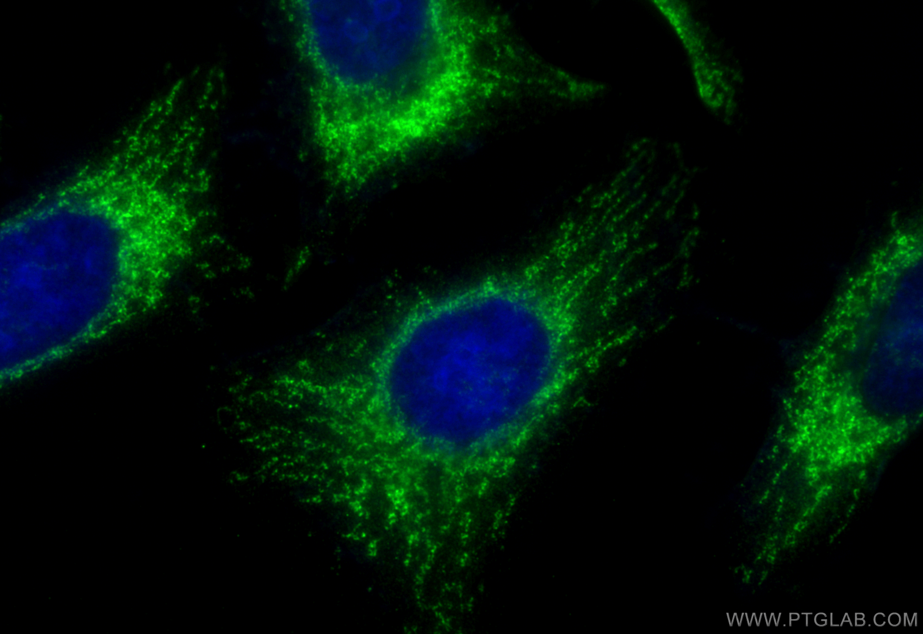 Immunofluorescence (IF) / fluorescent staining of HeLa cells using CoraLite® Plus 488-conjugated ATP5F1 Polyclonal an (CL488-15999)