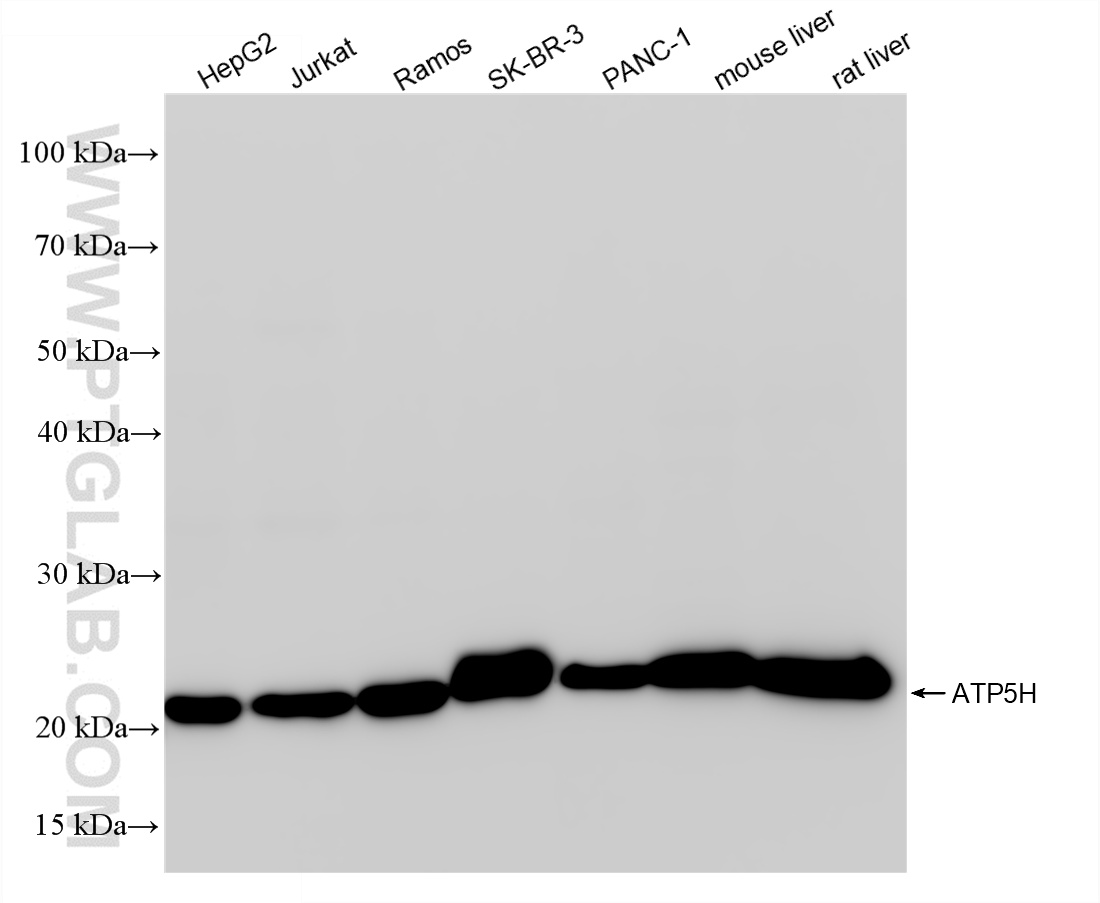 Western Blot (WB) analysis of various lysates using ATP5H Recombinant antibody (86174-2-RR)