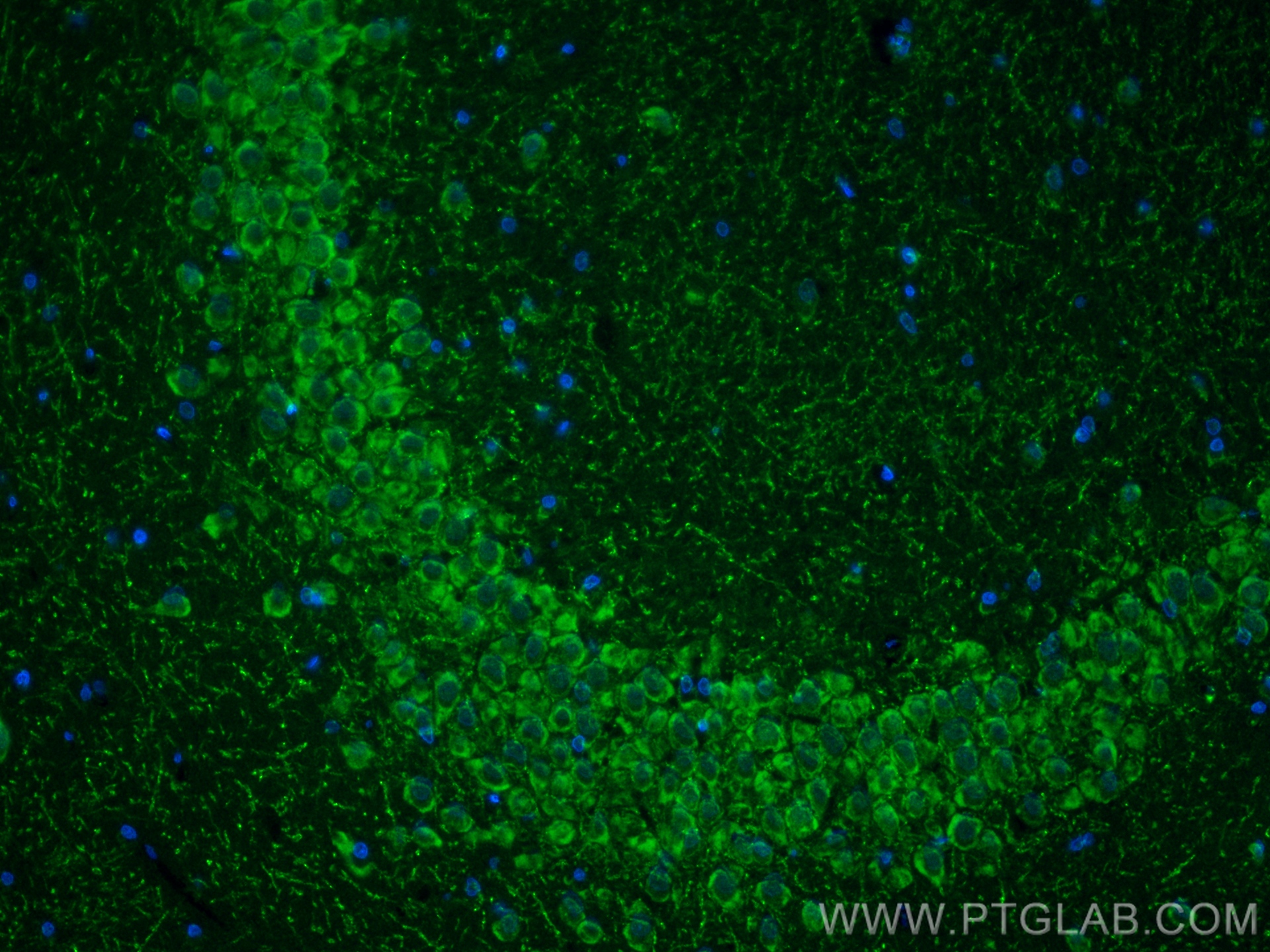 Immunofluorescence (IF) / fluorescent staining of rat brain tissue using ATP6 Recombinant antibody (83201-3-RR)