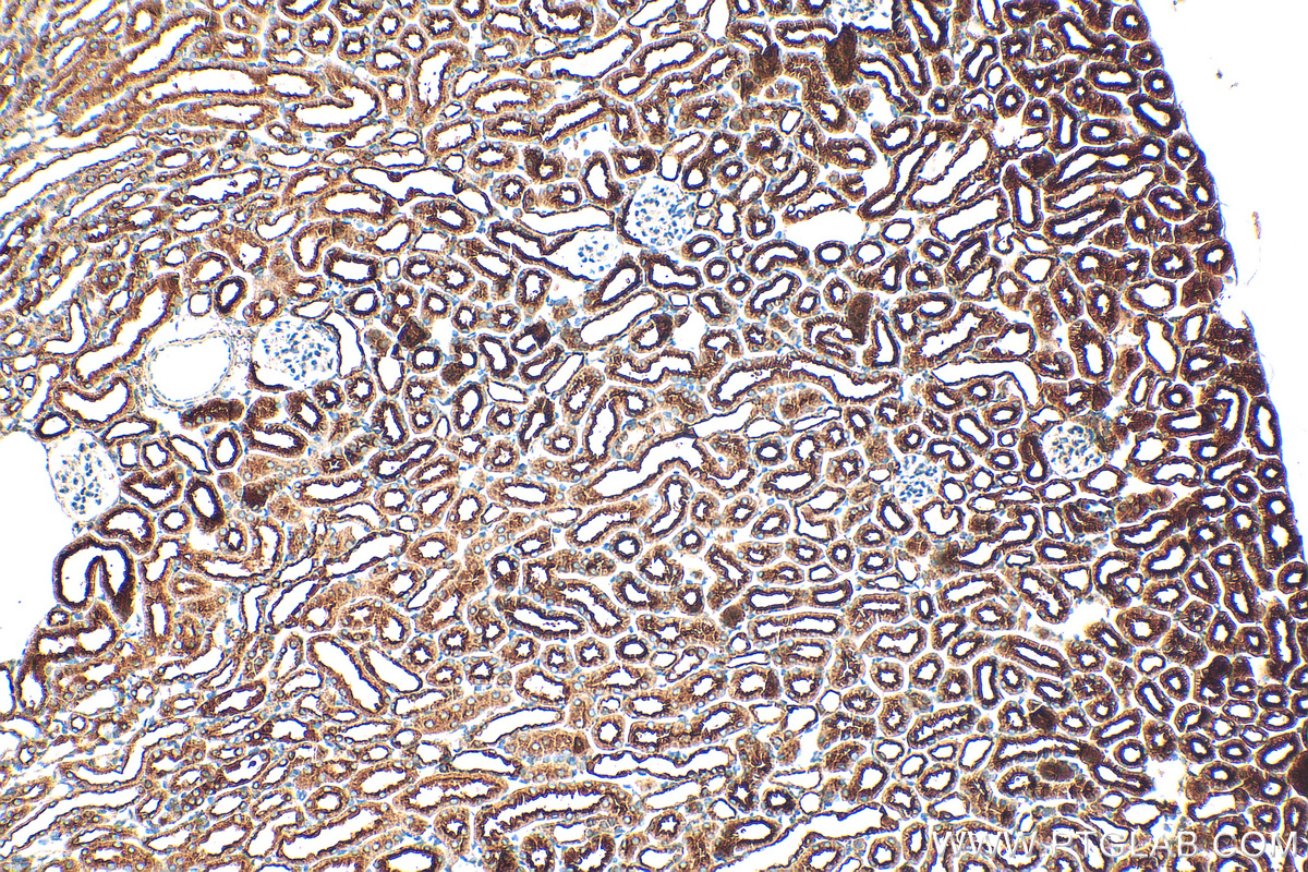 Immunohistochemistry (IHC) staining of mouse kidney tissue using ATP6V0D1 Polyclonal antibody (18274-1-AP)