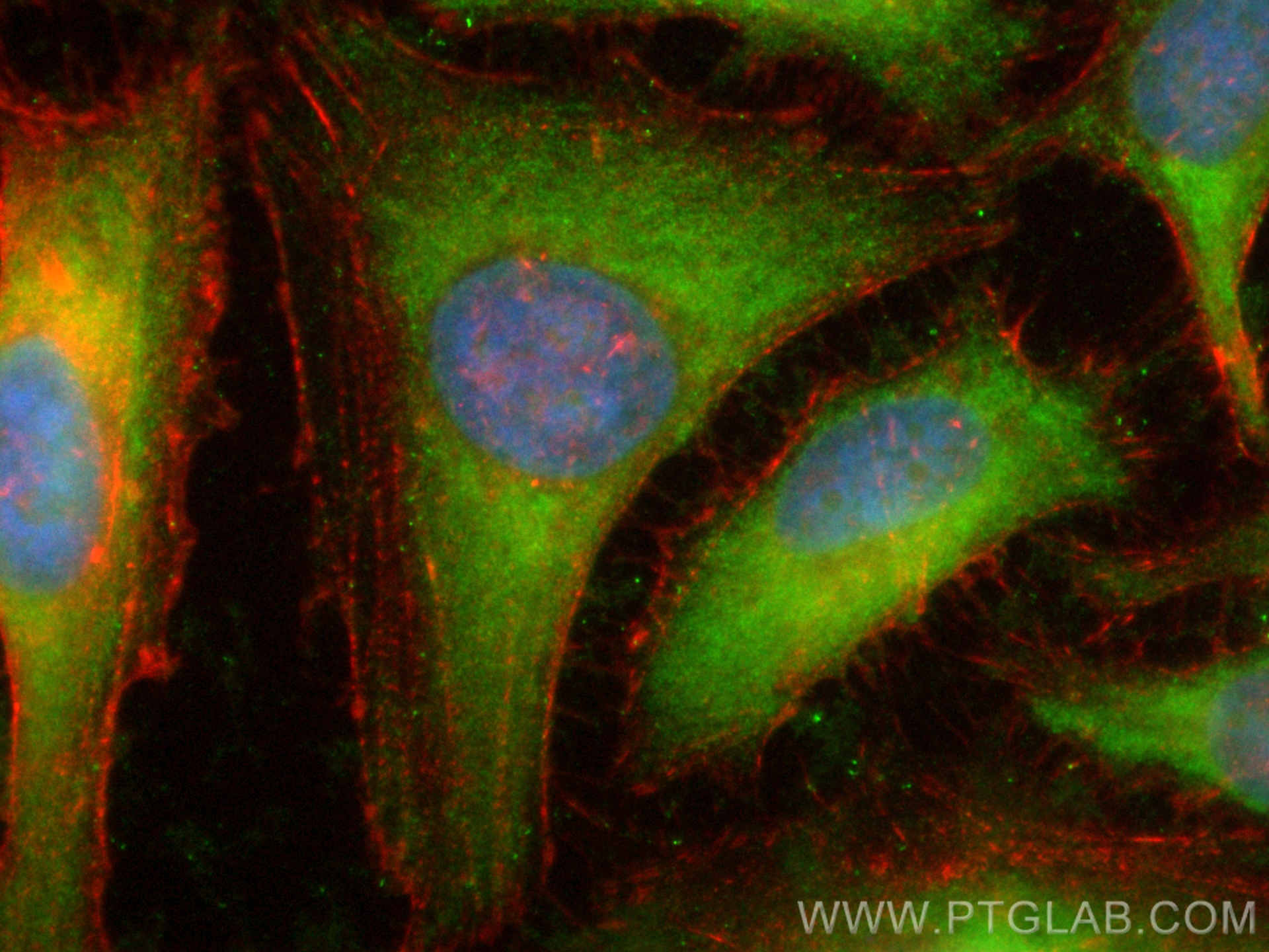 Immunofluorescence (IF) / fluorescent staining of HeLa cells using CoraLite® Plus 488-conjugated ATP6V0D1 Polyclonal  (CL488-18274)