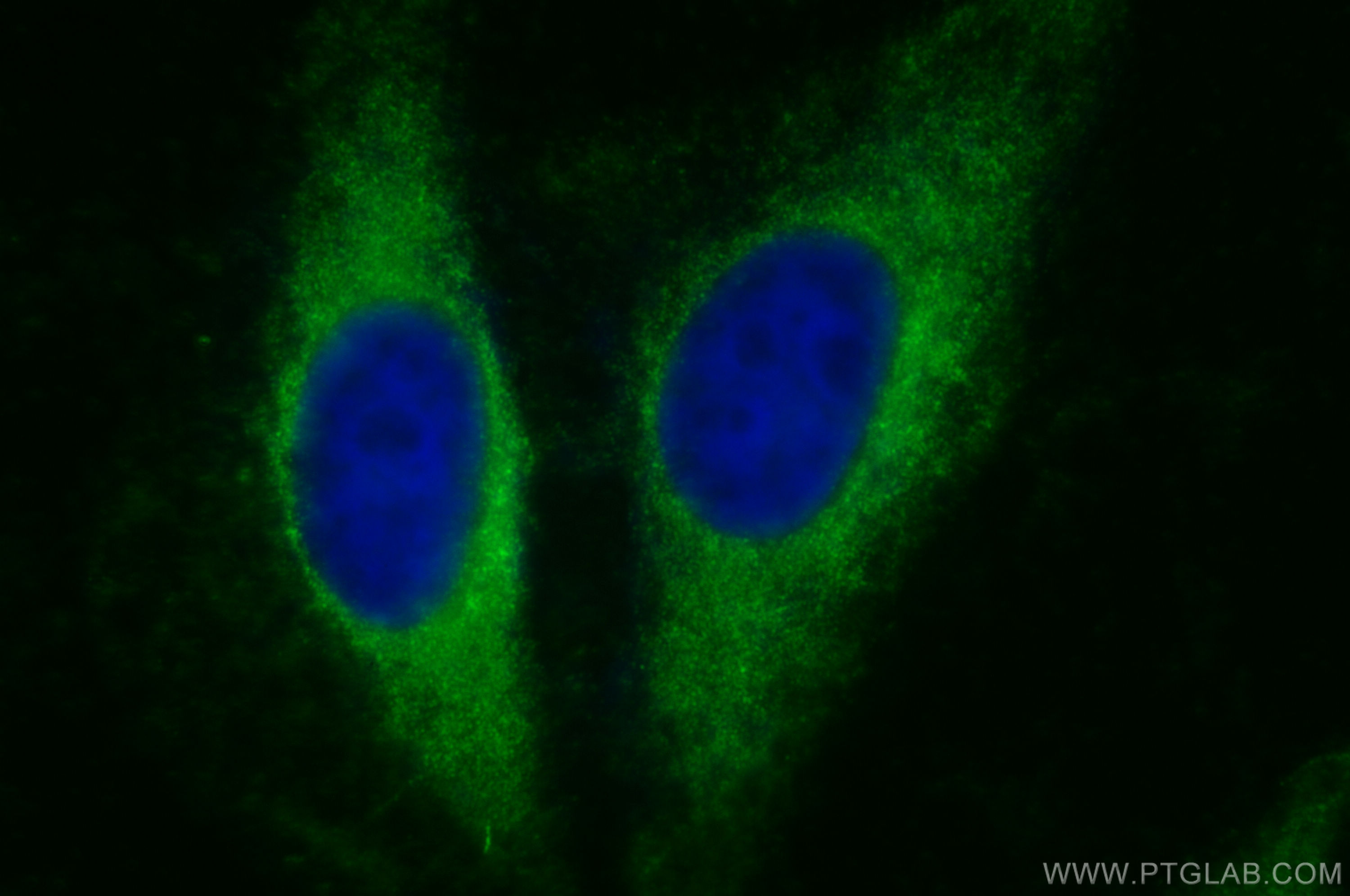 Immunofluorescence (IF) / fluorescent staining of HeLa cells using ATP6V1A Polyclonal antibody (17115-1-AP)