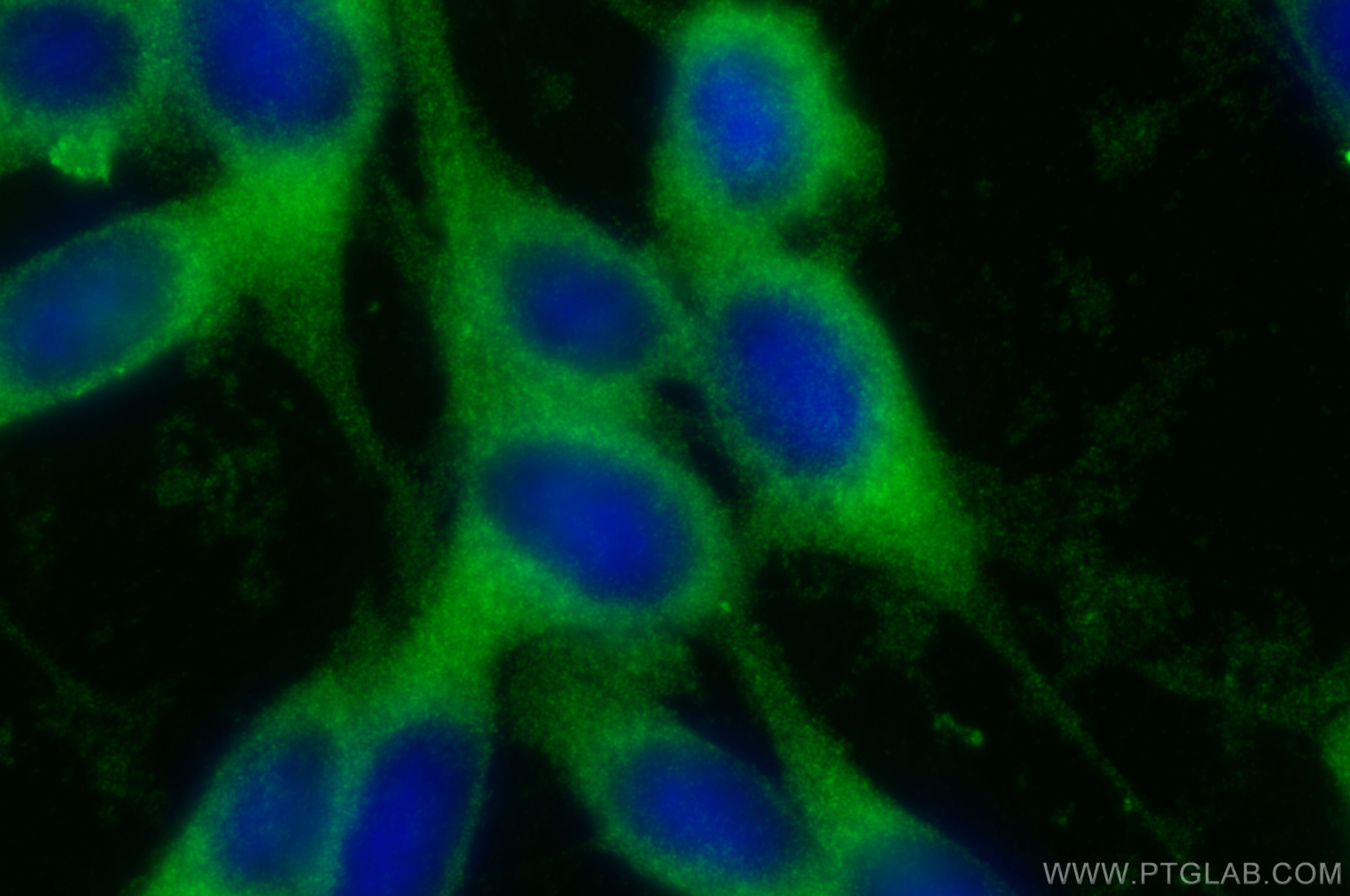 Immunofluorescence (IF) / fluorescent staining of NIH/3T3 cells using ATP6V1A Polyclonal antibody (17115-1-AP)