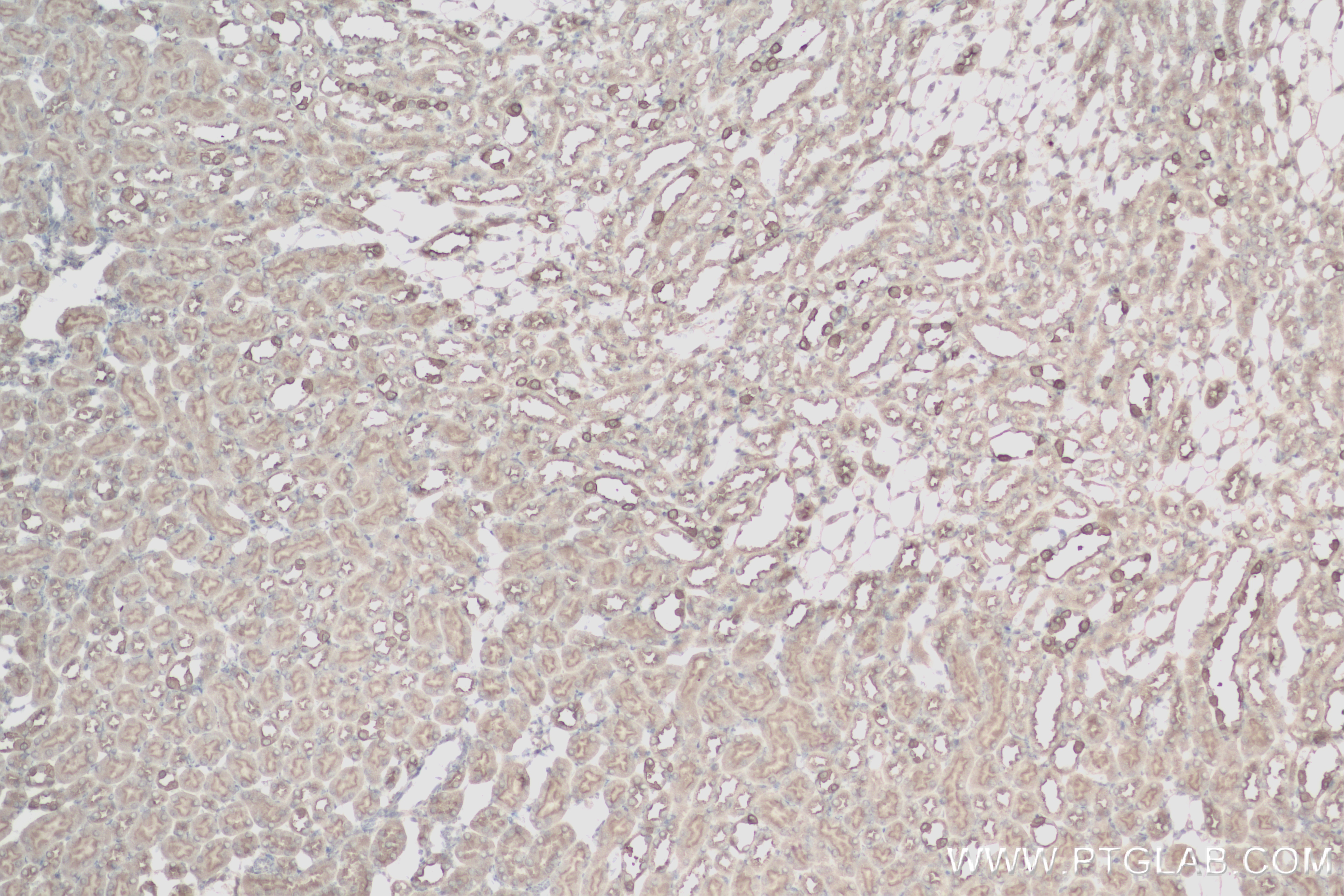 Immunohistochemistry (IHC) staining of mouse kidney tissue using ATP6V1B1 Recombinant antibody (83953-5-RR)