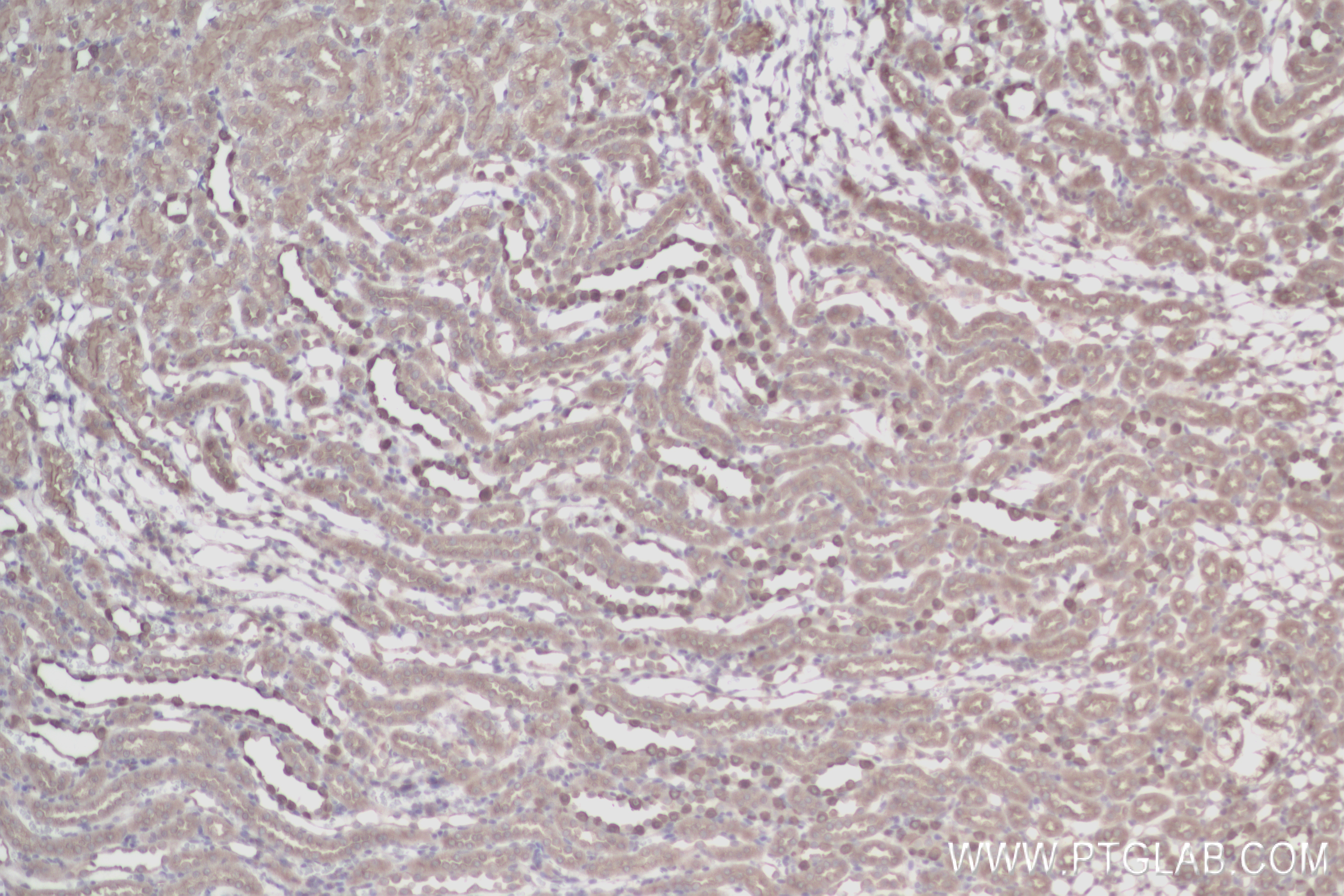 Immunohistochemistry (IHC) staining of rat kidney tissue using ATP6V1B1 Recombinant antibody (83953-5-RR)