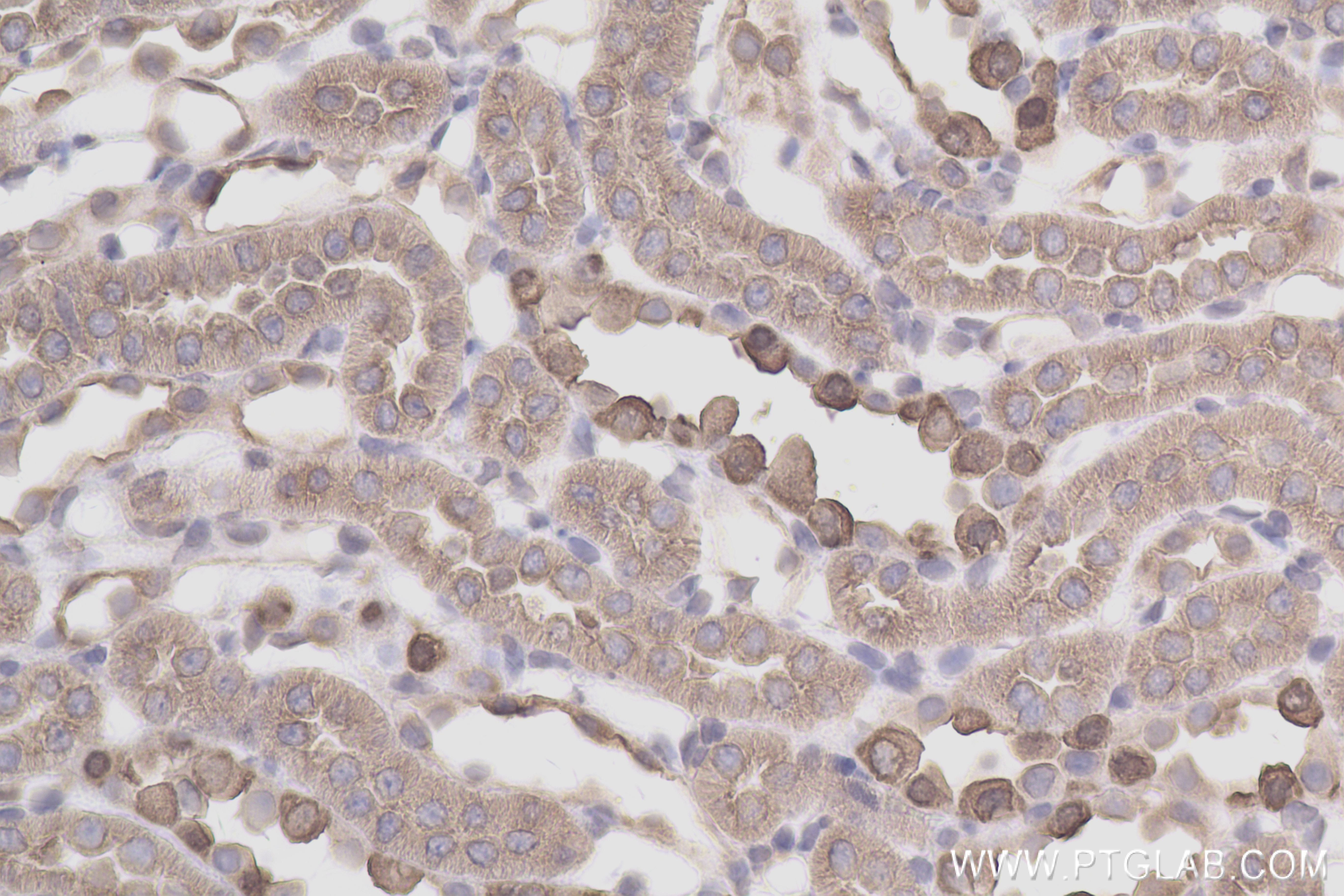 Immunohistochemistry (IHC) staining of rat kidney tissue using ATP6V1B1 Recombinant antibody (83953-5-RR)