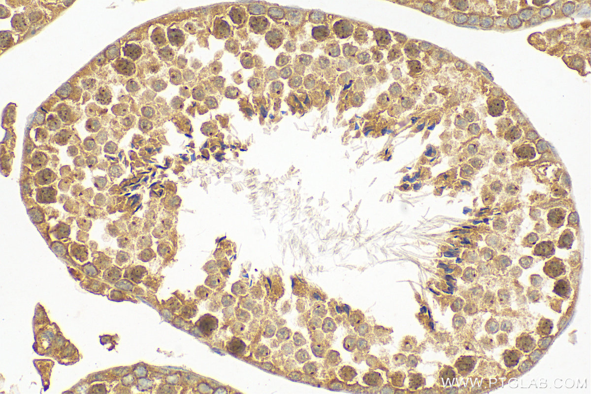 Immunohistochemistry (IHC) staining of mouse testis tissue using ATP6V1E1 Polyclonal antibody (15280-1-AP)