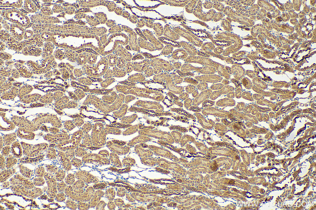 Immunohistochemistry (IHC) staining of rat kidney tissue using ATP6V1E1 Polyclonal antibody (15280-1-AP)