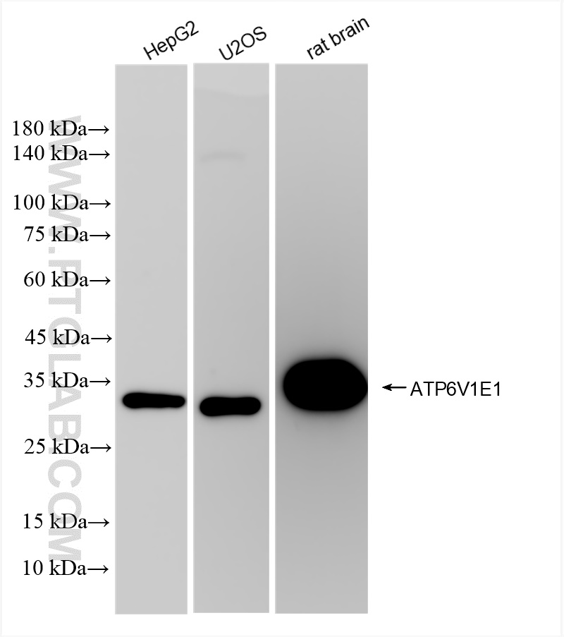 Western Blot (WB) analysis of various lysates using ATP6V1E1 Recombinant antibody (83636-6-RR)