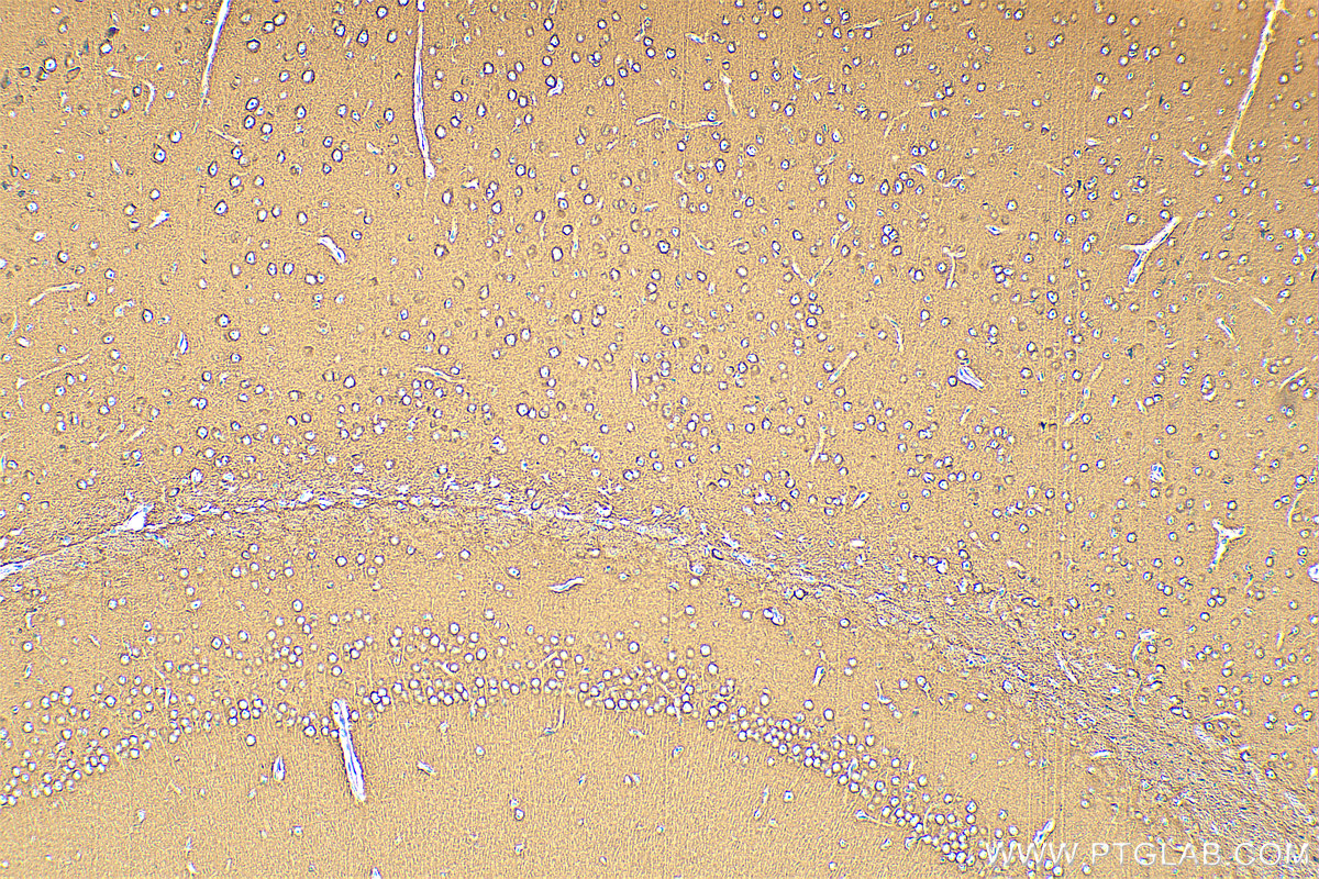 Immunohistochemistry (IHC) staining of mouse brain tissue using ATP6V1G2 Polyclonal antibody (25316-1-AP)