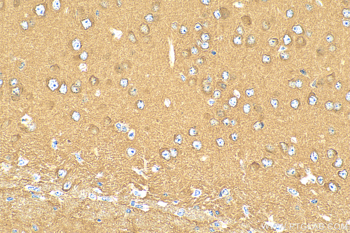 Immunohistochemistry (IHC) staining of mouse brain tissue using ATP6V1G2 Polyclonal antibody (25316-1-AP)