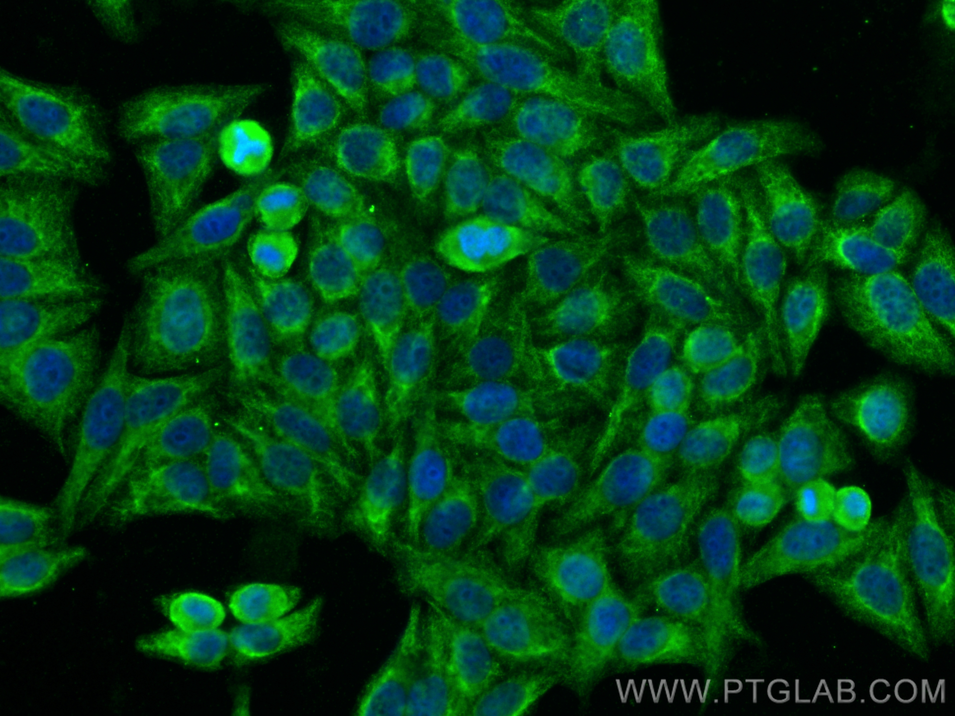 Immunofluorescence (IF) / fluorescent staining of HepG2 cells using ATP7B-Specific Polyclonal antibody (19786-1-AP)