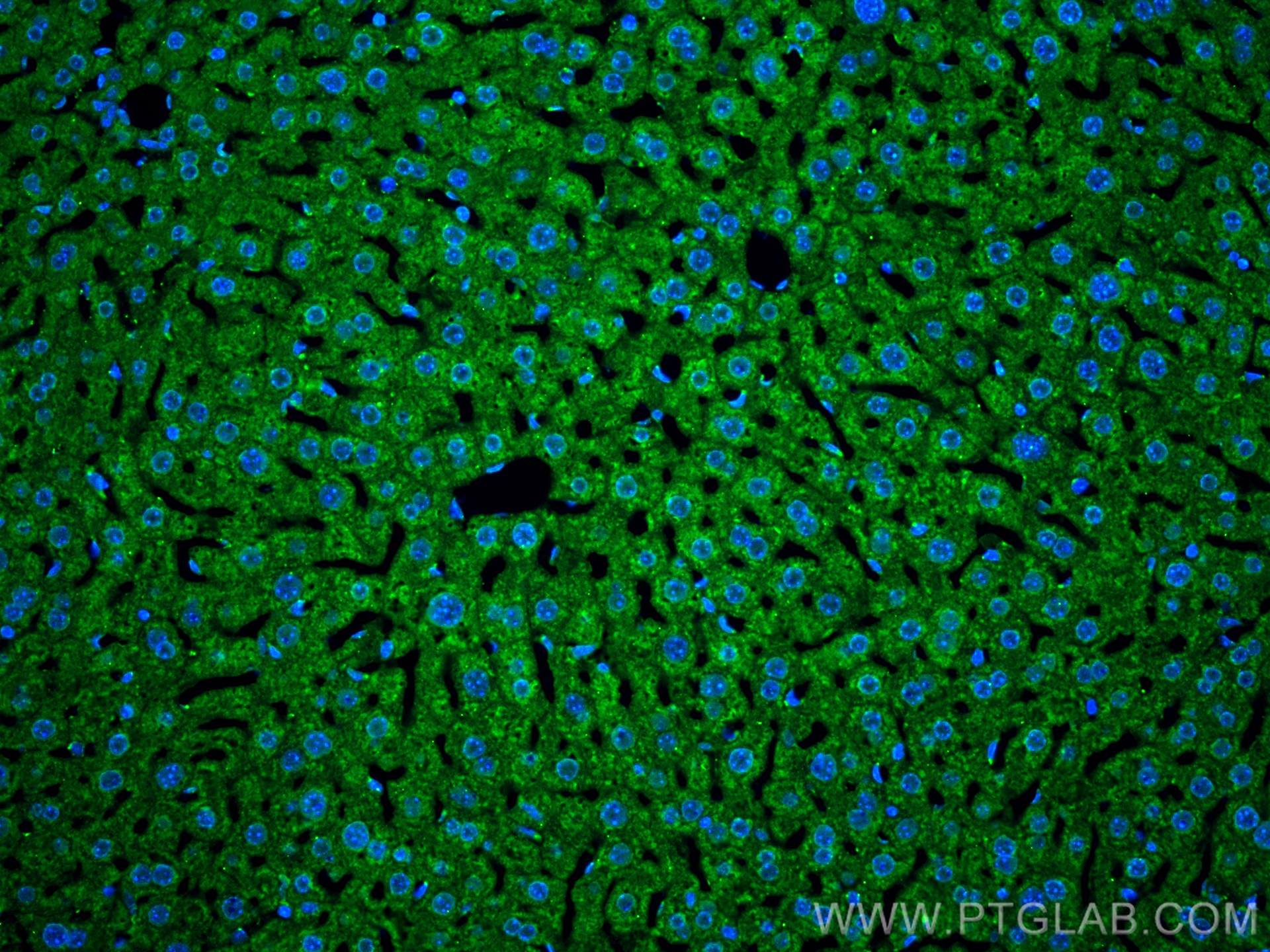 Immunofluorescence (IF) / fluorescent staining of mouse liver tissue using ATP7B-Specific Polyclonal antibody (19786-1-AP)