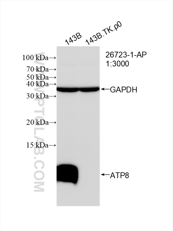 Western Blot (WB) analysis of 143B.TK.P0 cells using ATP8 Polyclonal antibody (26723-1-AP)