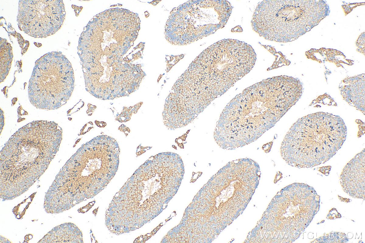 Immunohistochemistry (IHC) staining of mouse testis tissue using ATP8A2 Polyclonal antibody (31697-1-AP)