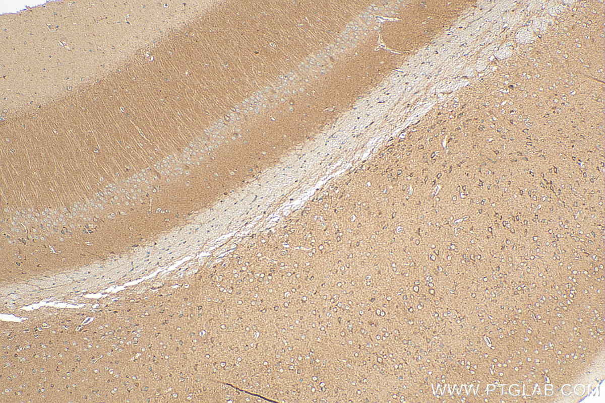 Immunohistochemistry (IHC) staining of mouse brain tissue using ATP8A2 Polyclonal antibody (31697-1-AP)