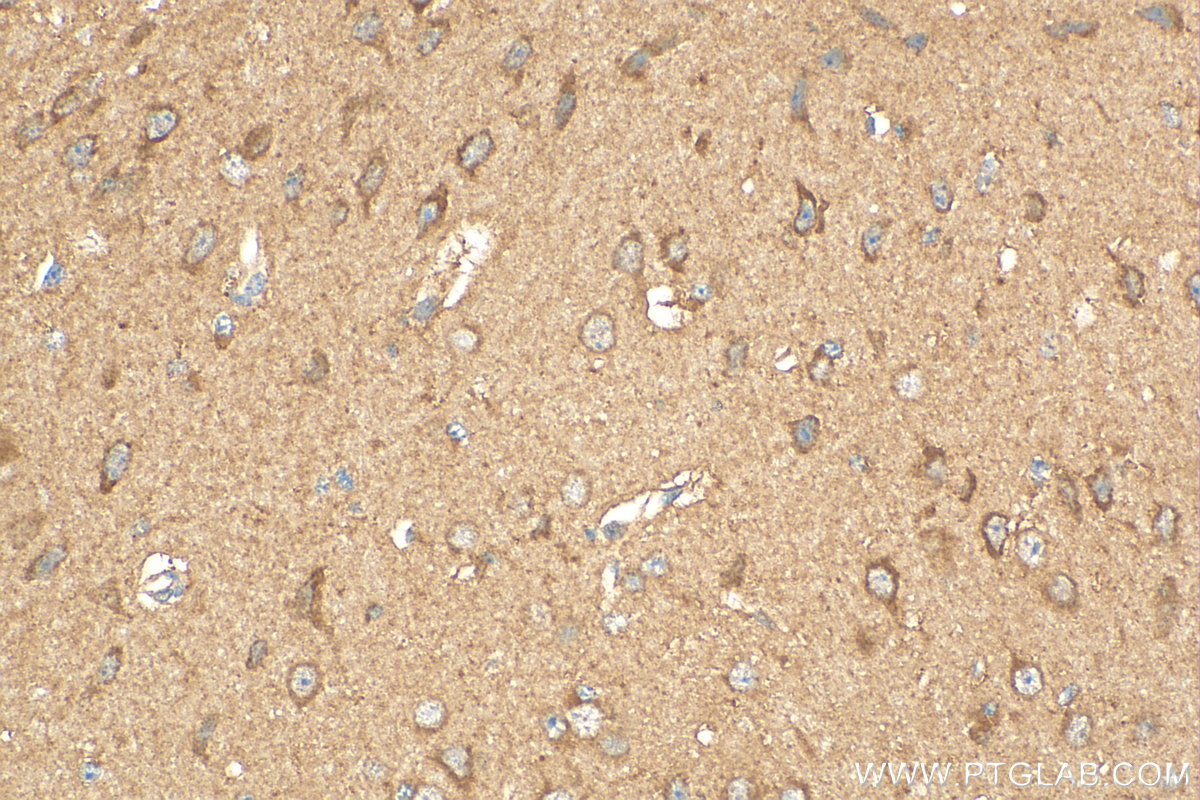 Immunohistochemistry (IHC) staining of mouse brain tissue using ATP8A2 Polyclonal antibody (31697-1-AP)