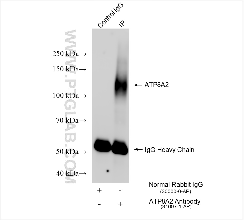 Immunoprecipitation (IP) experiment of mouse testis tissue using ATP8A2 Polyclonal antibody (31697-1-AP)