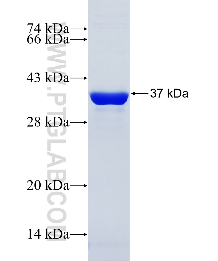 ATP8A2 fusion protein Ag36276 SDS-PAGE