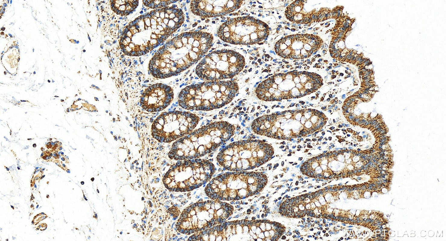 Immunohistochemistry (IHC) staining of human  colon using ATPB Polyclonal antibody (17247-1-AP)