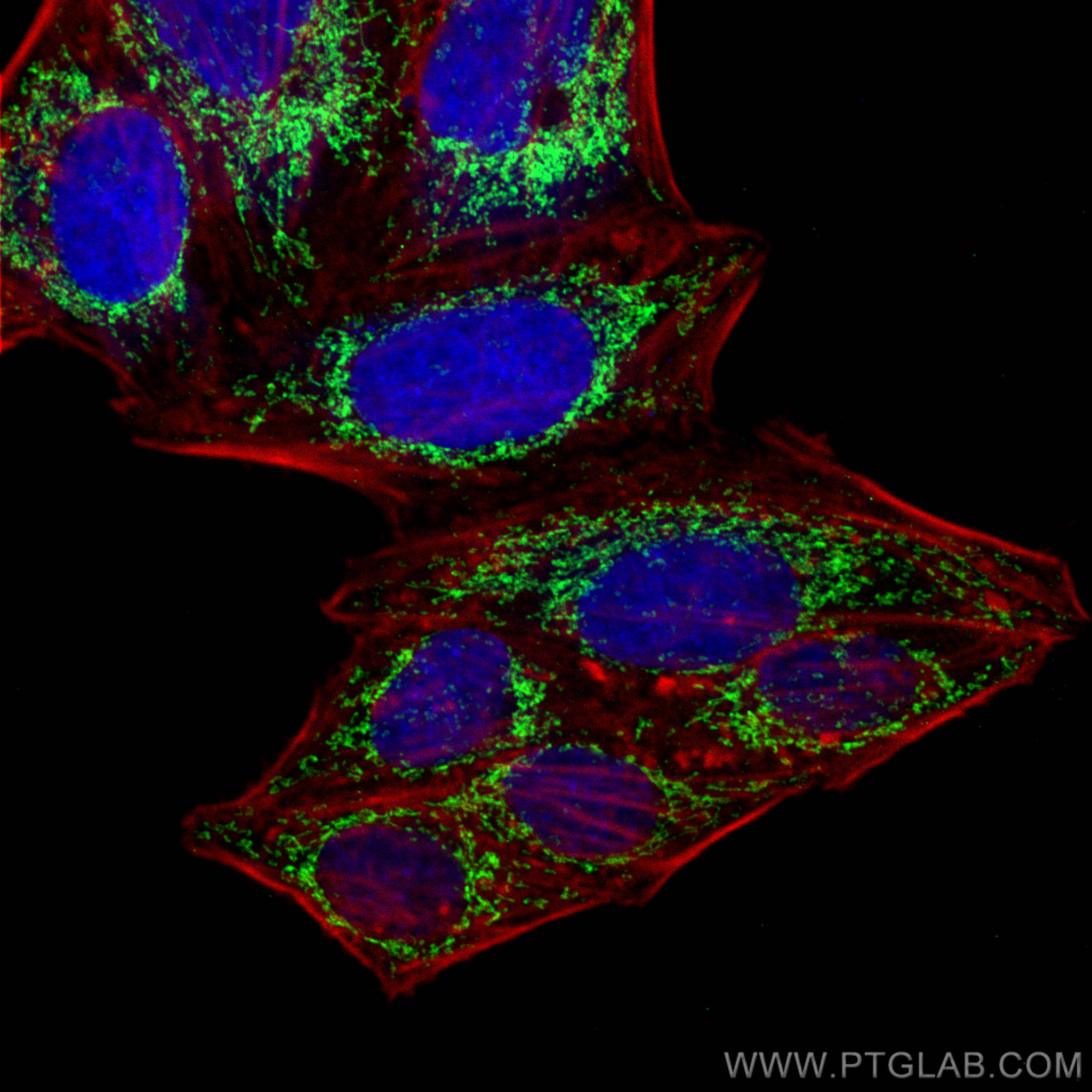 Immunofluorescence (IF) / fluorescent staining of HepG2 cells using ATPB Polyclonal antibody (17247-1-AP)