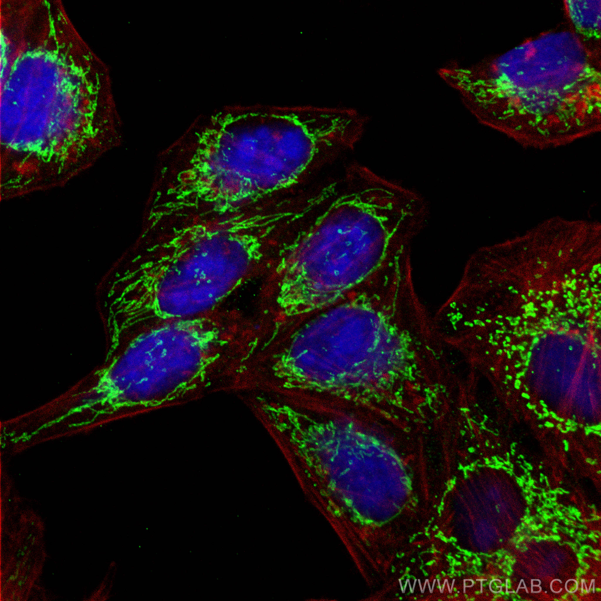 Immunofluorescence (IF) / fluorescent staining of HepG2 cells using ATPB Monoclonal antibody (66600-1-Ig)