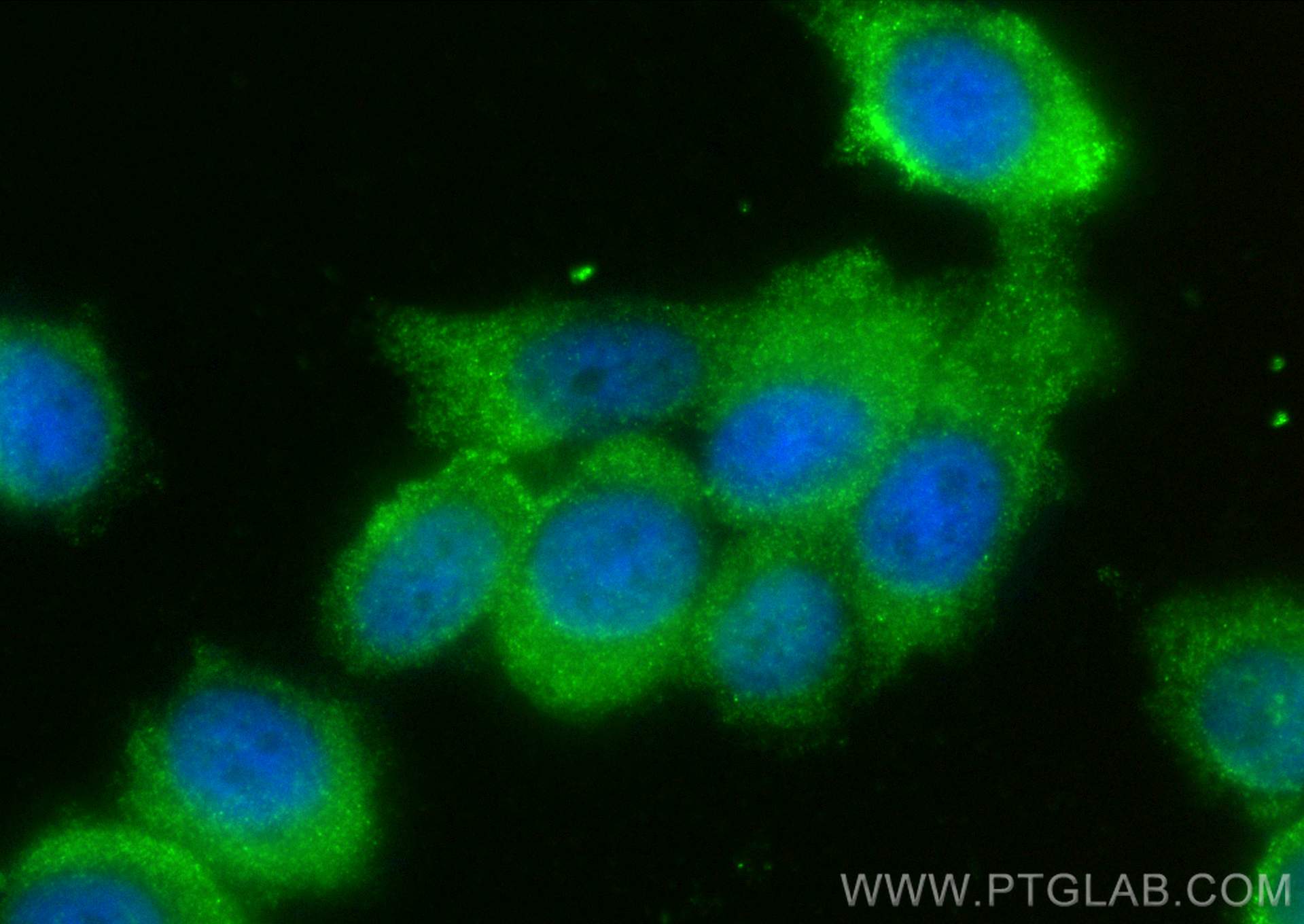 Immunofluorescence (IF) / fluorescent staining of PC-3 cells using ATPBD3 Polyclonal antibody (31537-1-AP)