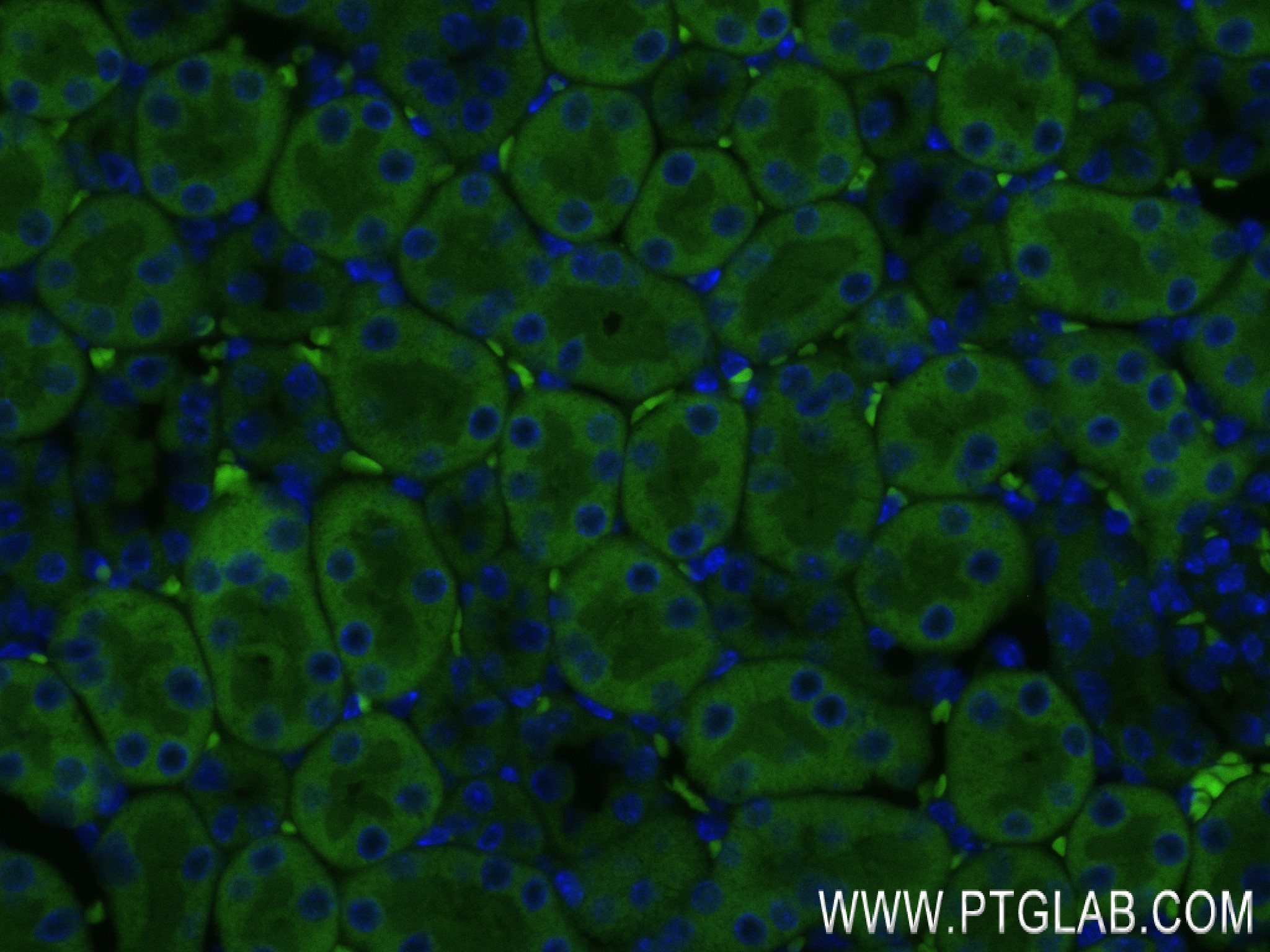 Immunofluorescence (IF) / fluorescent staining of mouse kidney tissue using ATPBD3 Recombinant antibody (84318-4-RR)