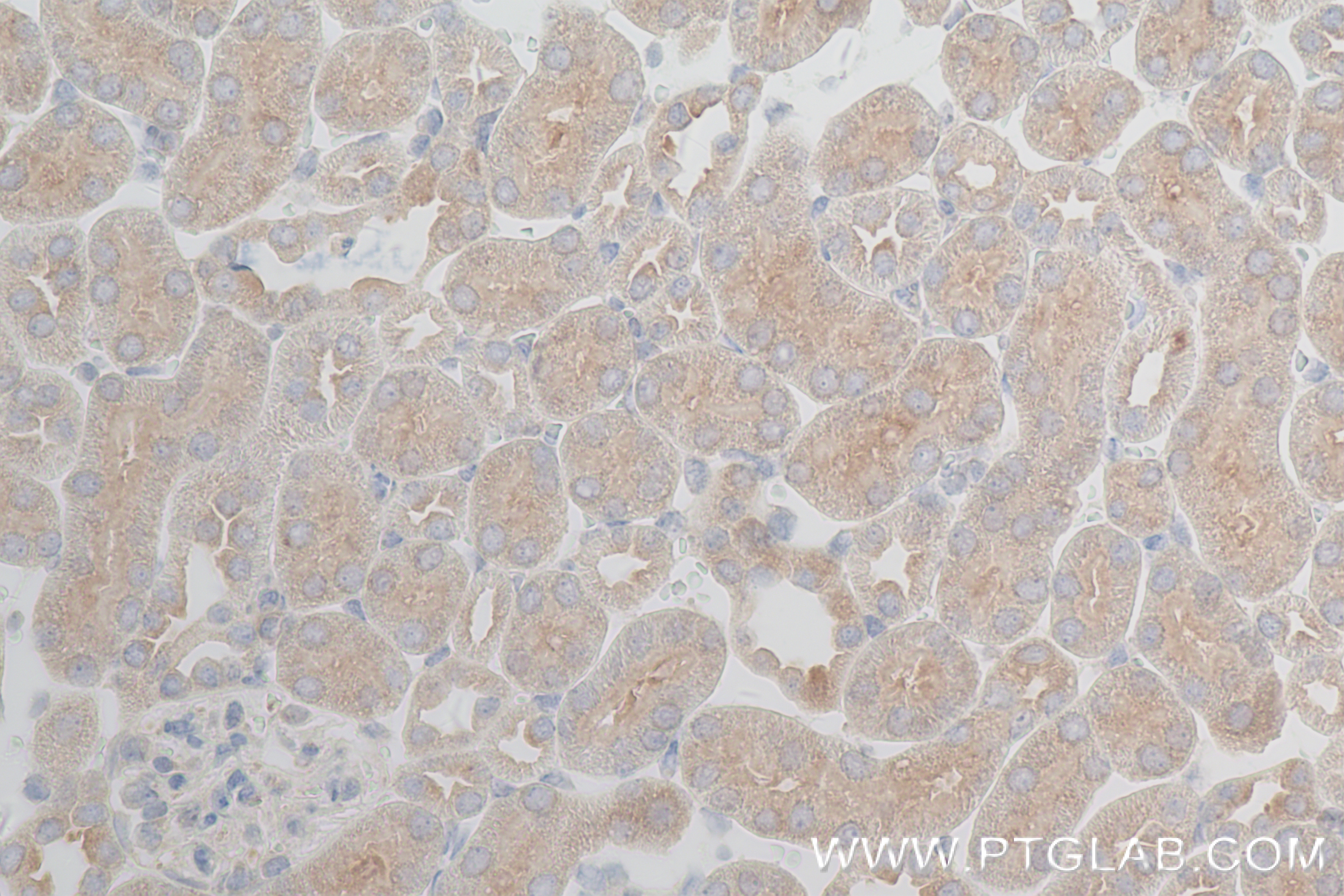 Immunohistochemistry (IHC) staining of mouse kidney tissue using ATPBD3 Recombinant antibody (84318-4-RR)