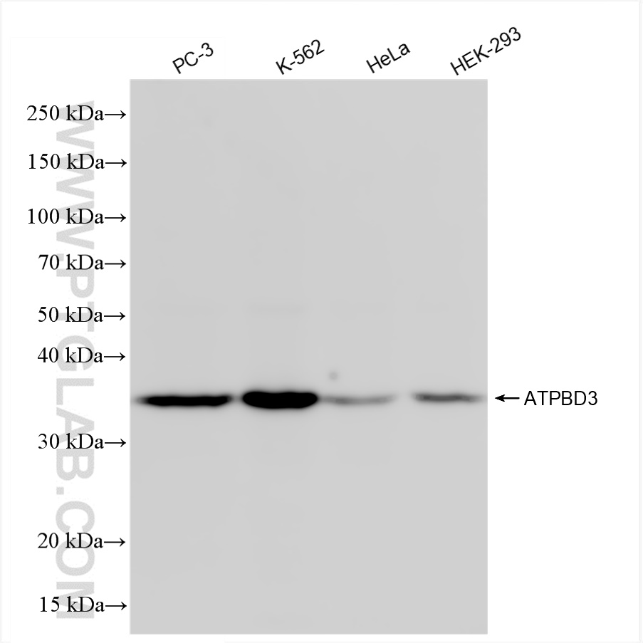 Western Blot (WB) analysis of various lysates using ATPBD3 Recombinant antibody (84318-4-RR)