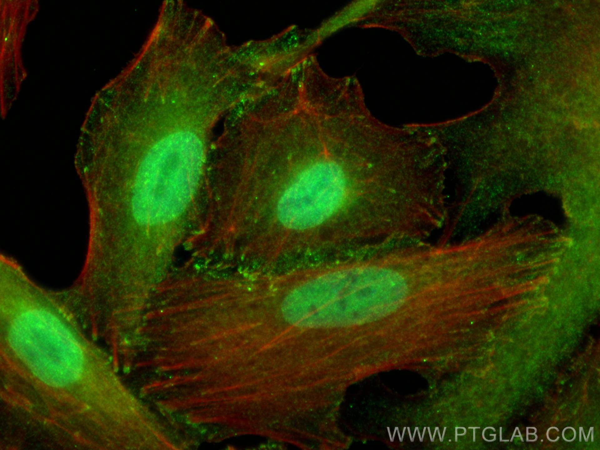 Immunofluorescence (IF) / fluorescent staining of A549 cells using CoraLite® Plus 488-conjugated ATX3,ATXN3 Monoclona (CL488-67057)