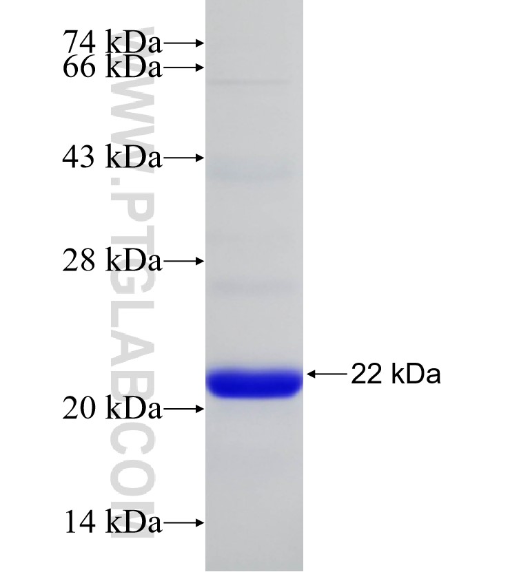ATXN1 fusion protein Ag31160 SDS-PAGE