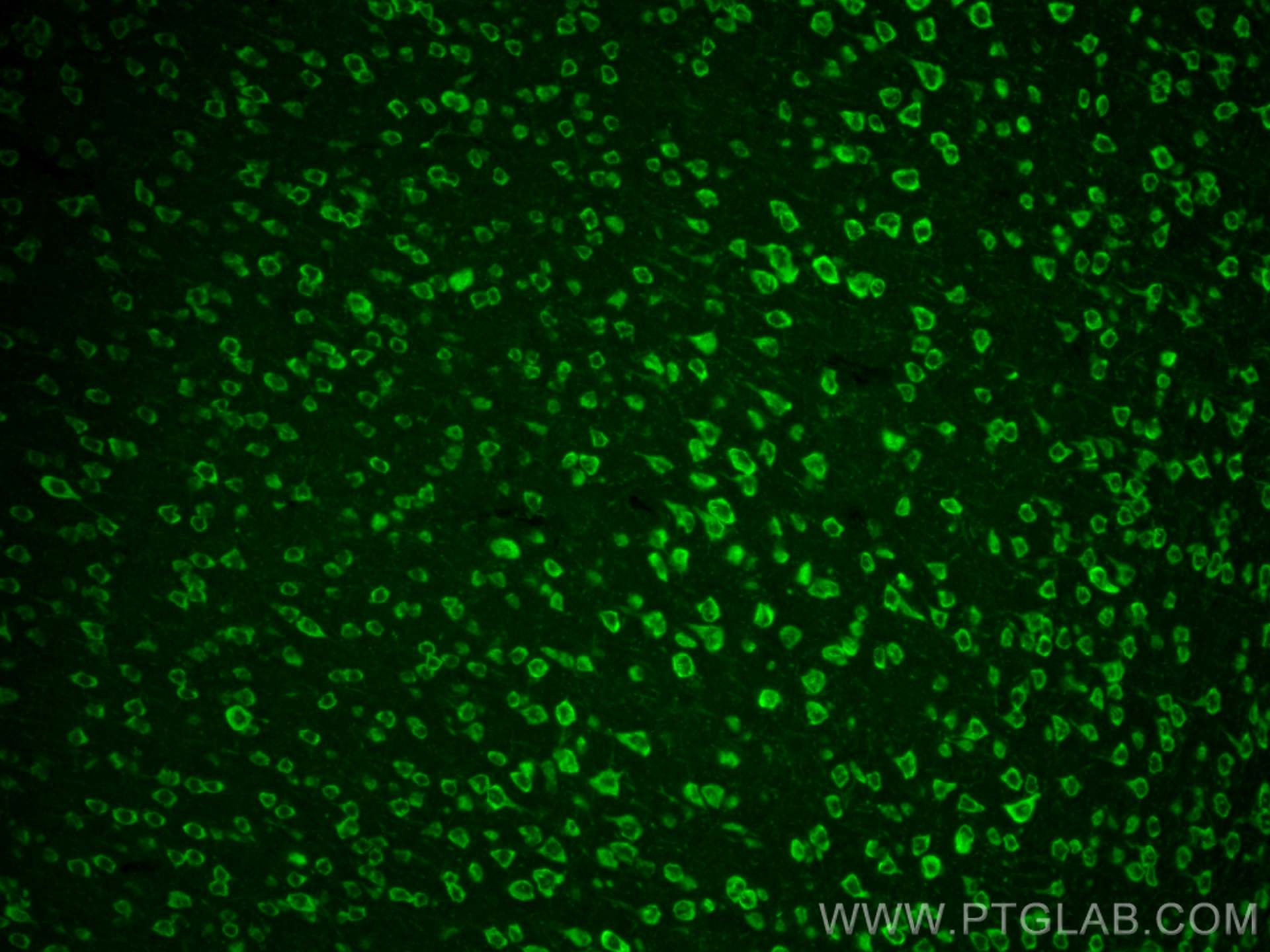 Immunofluorescence (IF) / fluorescent staining of mouse brain tissue using Ataxin 2 Polyclonal antibody (21776-1-AP)