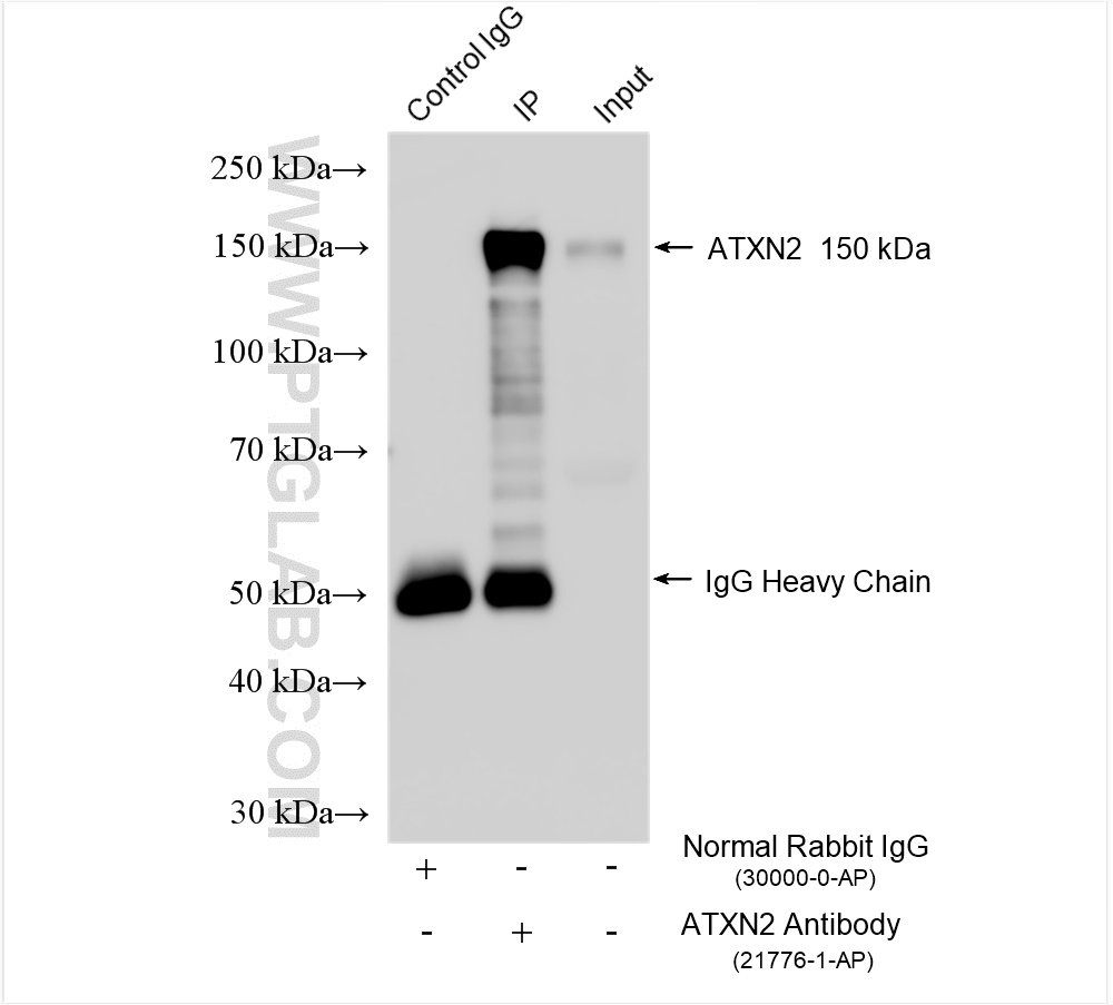 Immunoprecipitation (IP) experiment of HEK-293 cells using Ataxin 2 Polyclonal antibody (21776-1-AP)