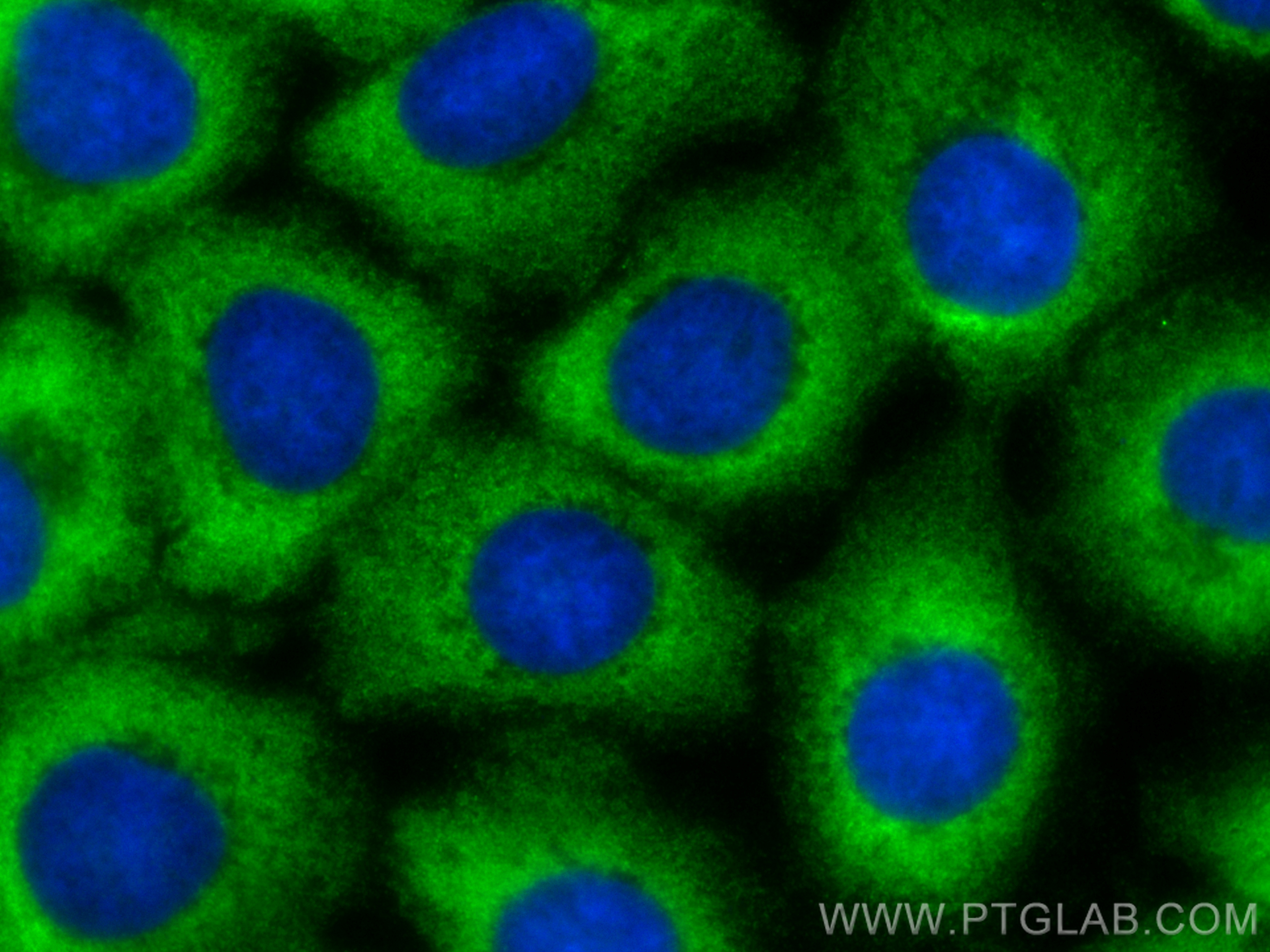 Immunofluorescence (IF) / fluorescent staining of A431 cells using CoraLite® Plus 488-conjugated ATXN2L Polyclonal an (CL488-24822)