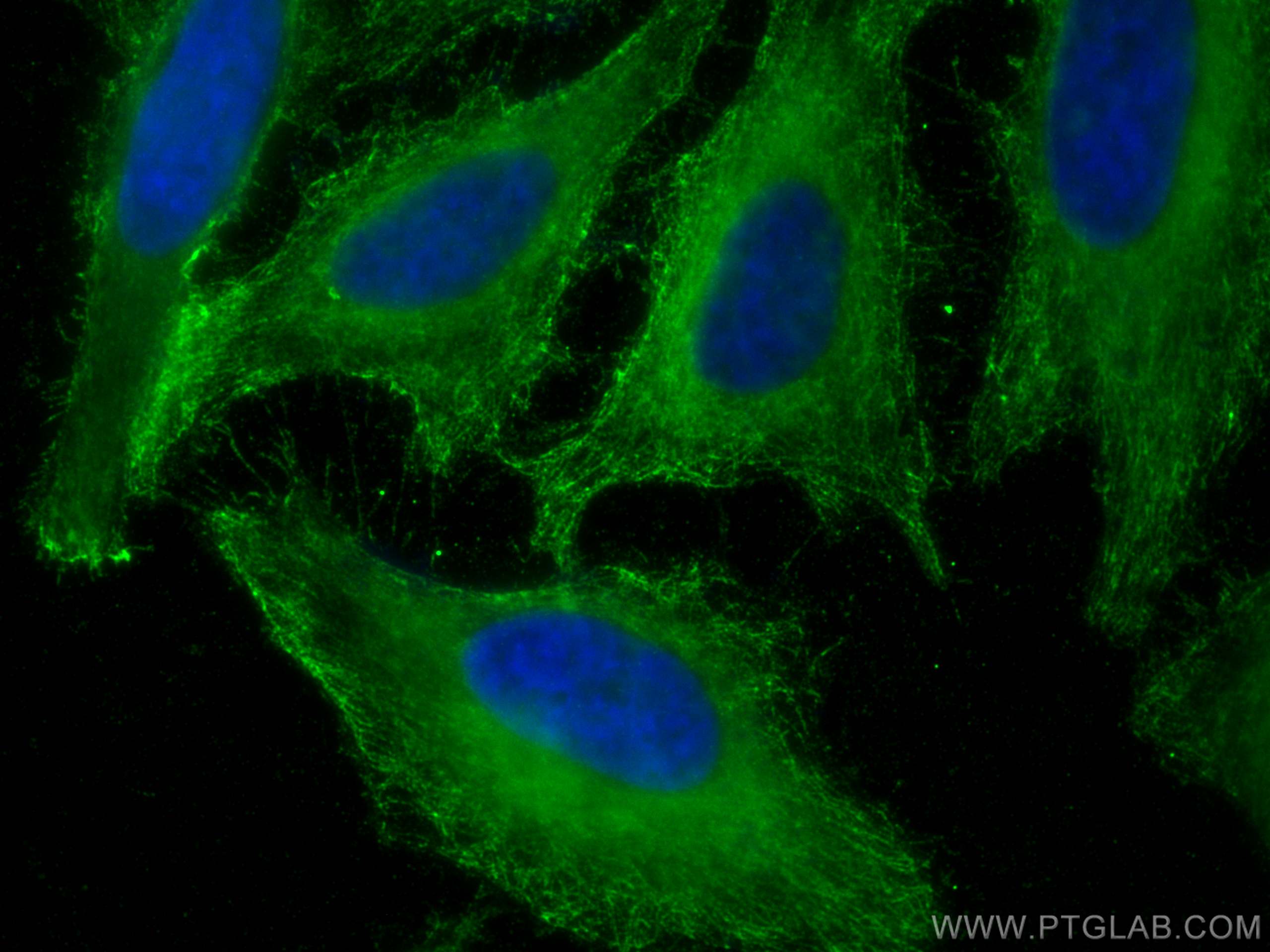 Immunofluorescence (IF) / fluorescent staining of HeLa cells using AURKA Monoclonal antibody (66757-1-Ig)