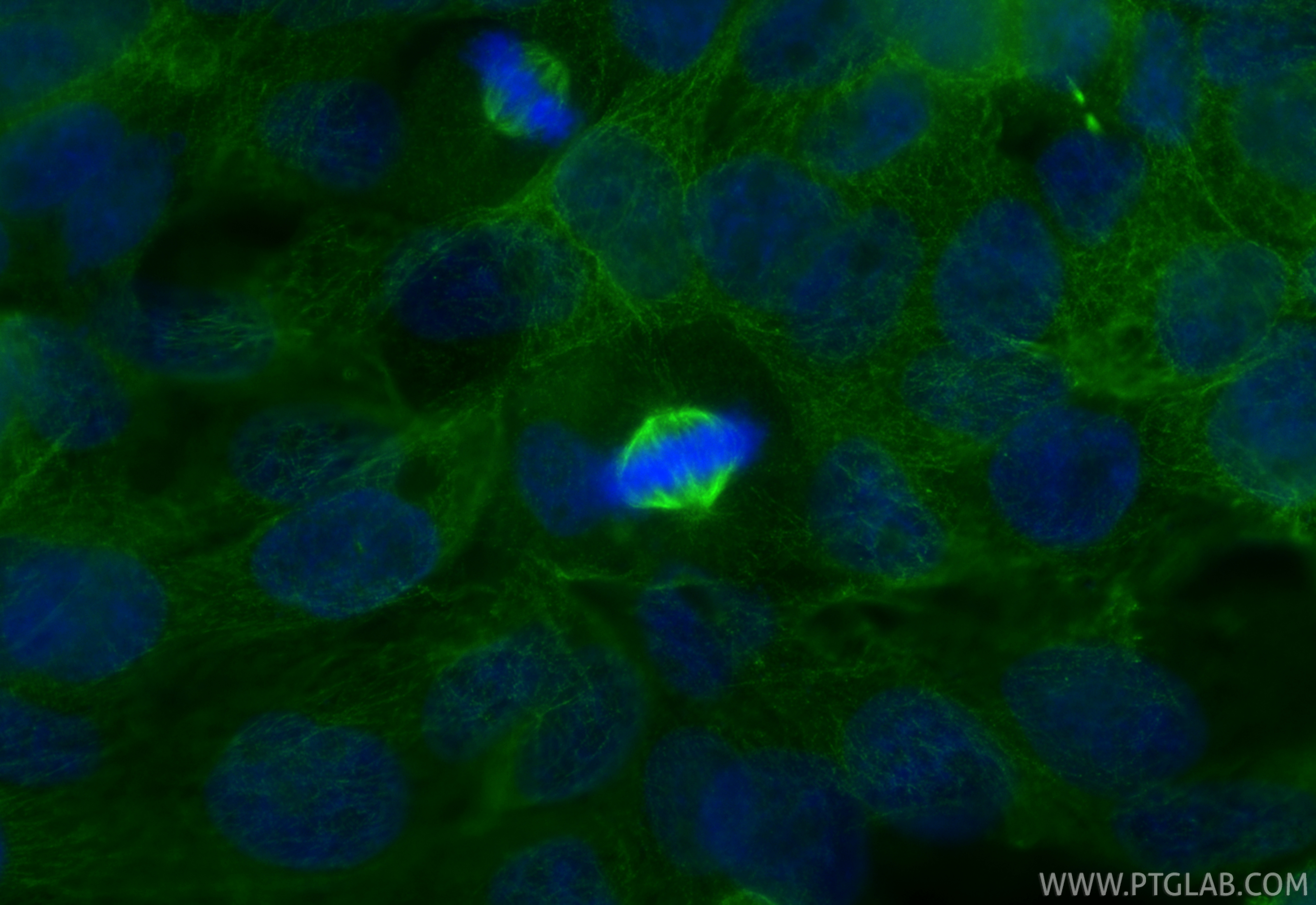 Immunofluorescence (IF) / fluorescent staining of A431 cells using AURKA Monoclonal antibody (66757-1-Ig)