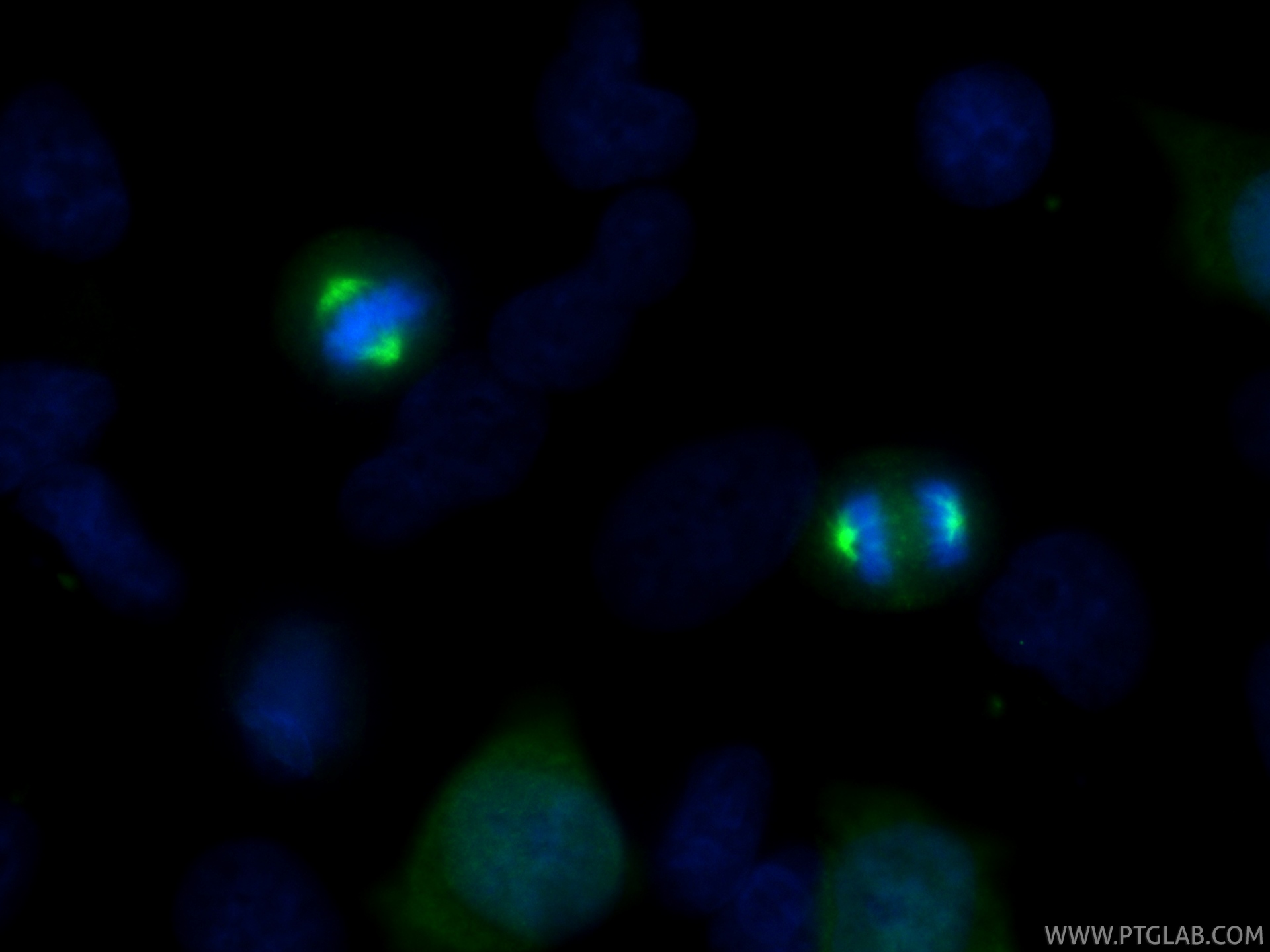 Immunofluorescence (IF) / fluorescent staining of HeLa cells using AURKA Recombinant monoclonal antibody (82906-2-RR)