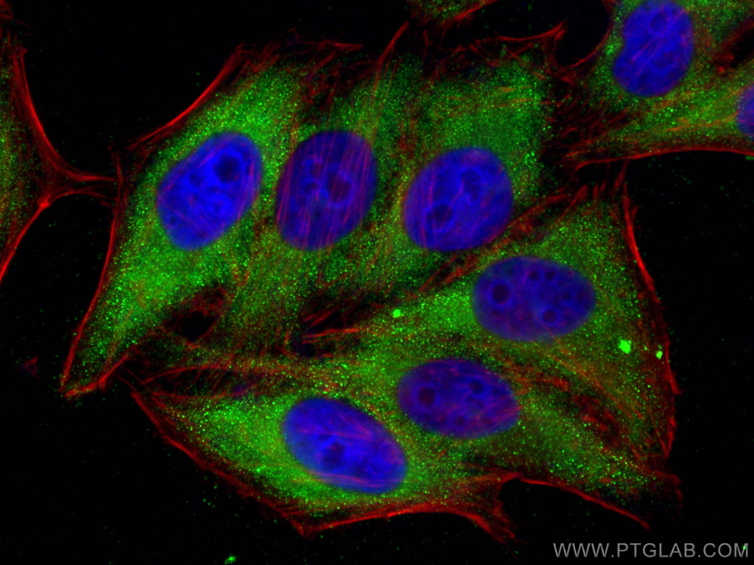 Immunofluorescence (IF) / fluorescent staining of HepG2 cells using Zinc Alpha 2 Glycoprotein Polyclonal antibody (13399-1-AP)