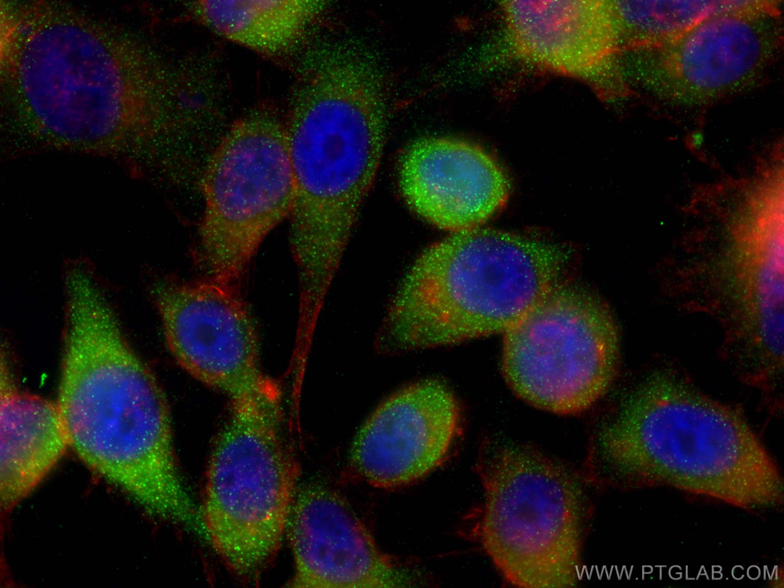 Immunofluorescence (IF) / fluorescent staining of PC-3 cells using Zinc Alpha 2 Glycoprotein Polyclonal antibody (13399-1-AP)