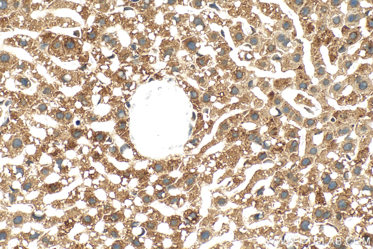 Immunohistochemistry (IHC) staining of mouse liver tissue using Zinc Alpha 2 Glycoprotein Polyclonal antibody (13399-1-AP)