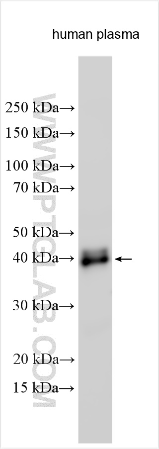 Western Blot (WB) analysis of various lysates using Zinc Alpha 2 Glycoprotein Polyclonal antibody (13399-1-AP)