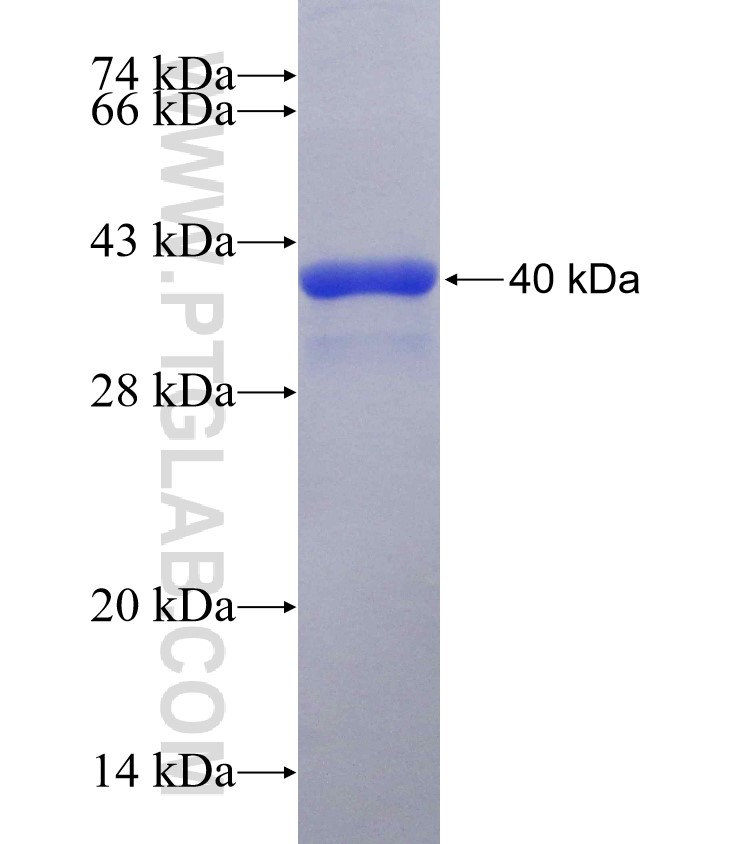 AZIN1 fusion protein Ag30207 SDS-PAGE