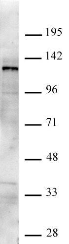 AbFlex JMJD2C / KDM4C antibody tested by Western blot. Nuclear extract of HepG2 cells (20 ug) probed with JMJD2C/KDM4C antibody at 0.5 ug/ml.