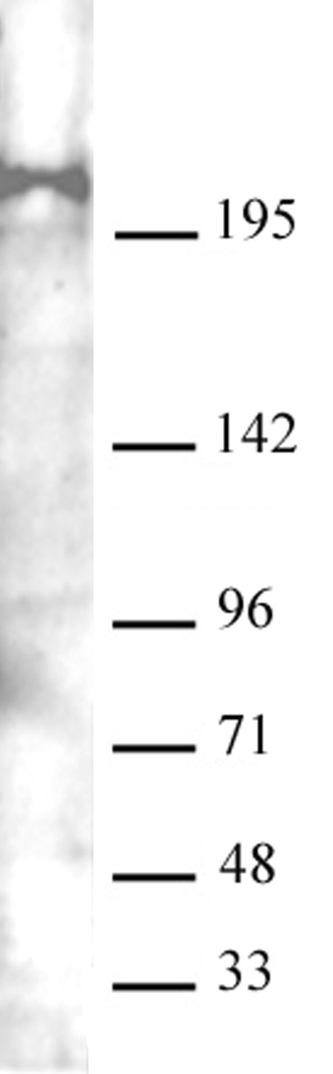 AbFlex Mi-2 beta (CHD4) antibody (rAb) tested by Western blot 20 ug of Jurkat cell nuclear extract was run on SDS-PAGE and probed with AbFlex Mi-2 beta (CHD4) antibody at 0.5 ug/ml.