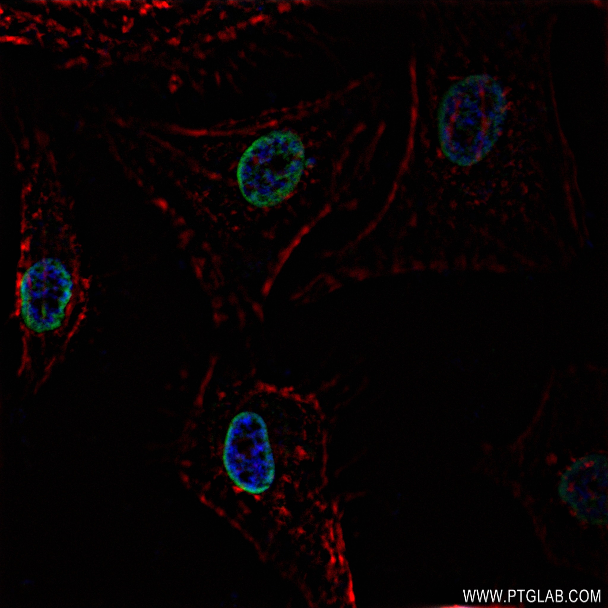 Immunofluorescence (IF) / fluorescent staining of HeLa cells using Acetyl-Histone H2A (Lys9) Recombinant antibody (83041-1-RR)
